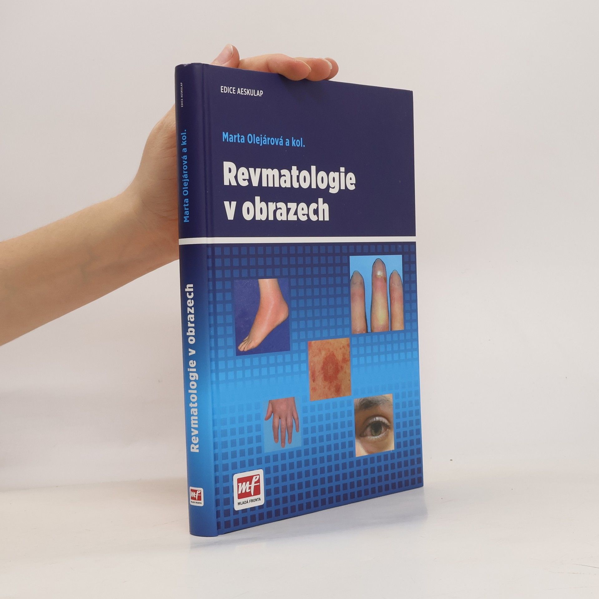 Marta Olejárová Revmatologie v obrazech