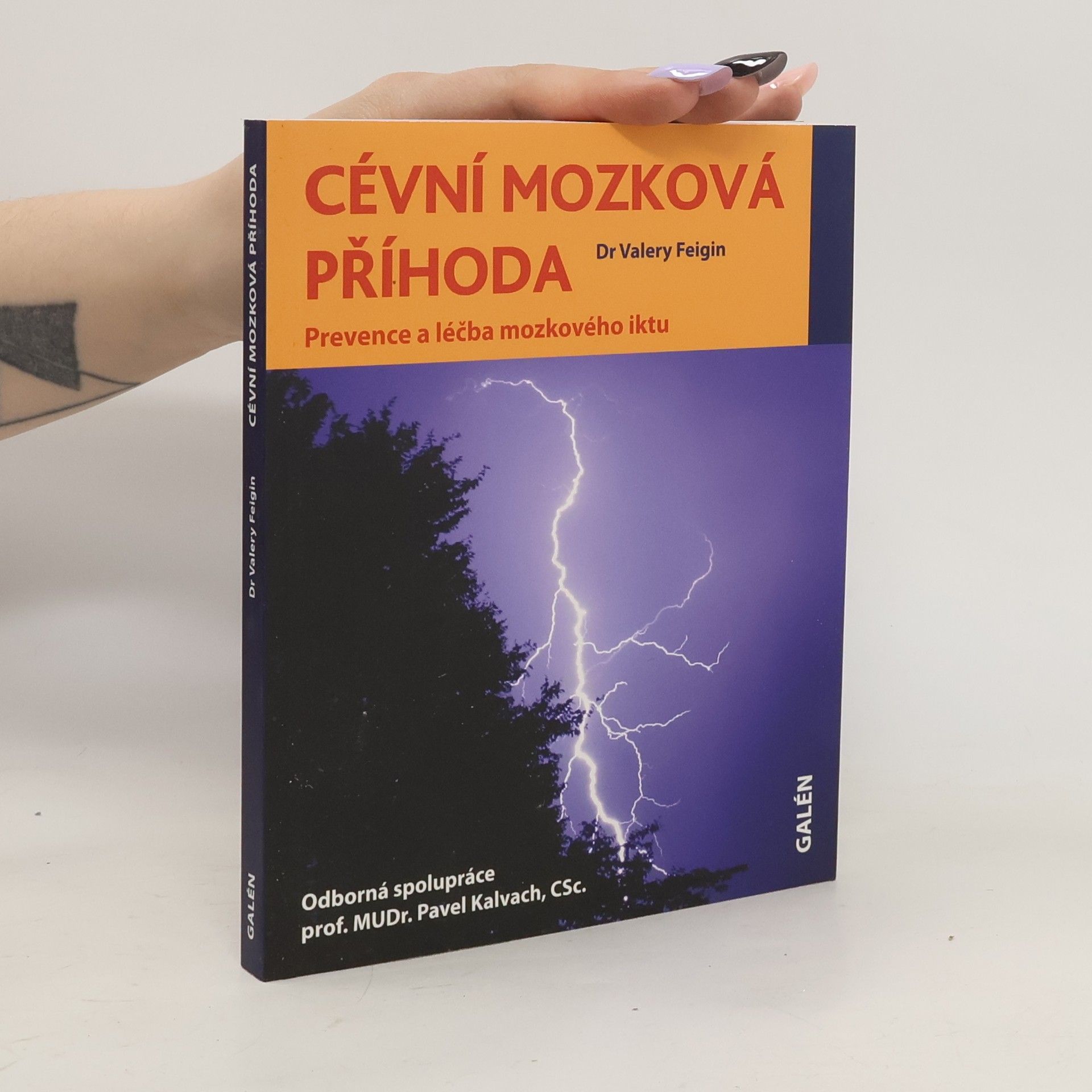 Valery L. Feigin Cévní mozková příhoda - Prevence a léčba mozkového iktu