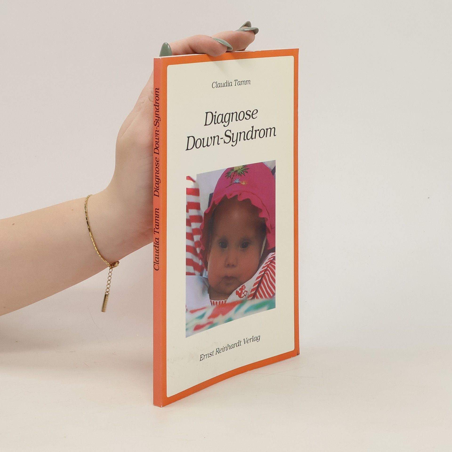 Claudia Tamm Diagnose Down-Syndrom