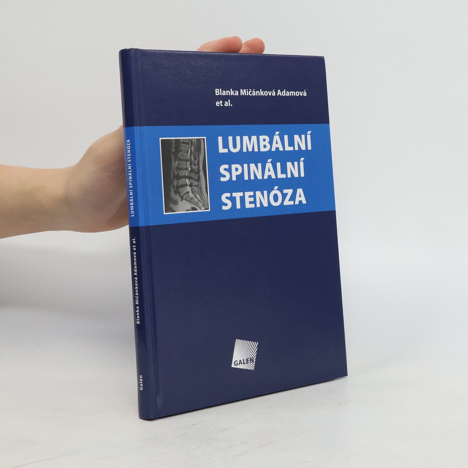 Blanka Mičánková Lumbální spinální stenóza