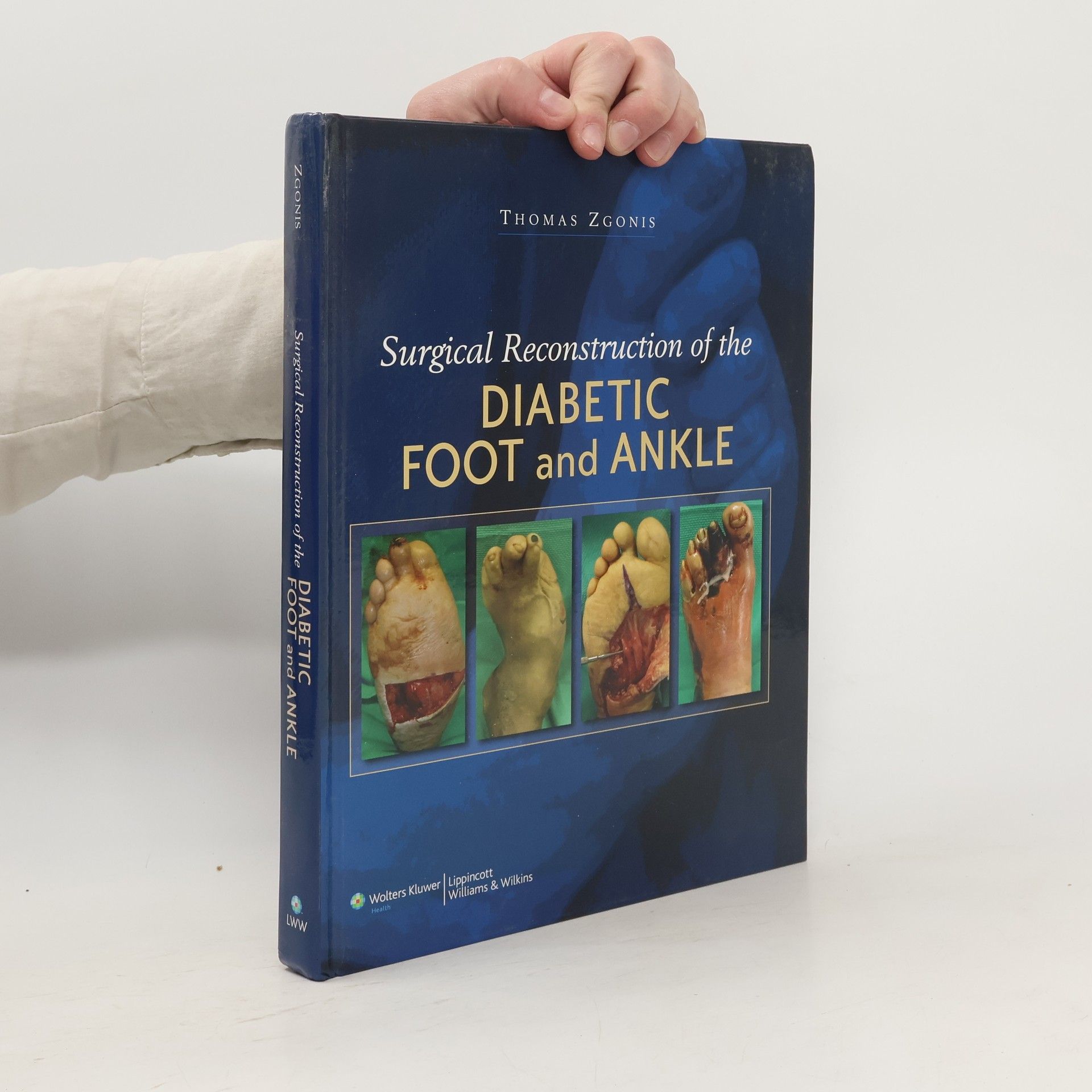 Thomas Zgonis Surgical Reconstruction of the Diabetic Foot and Ankle
