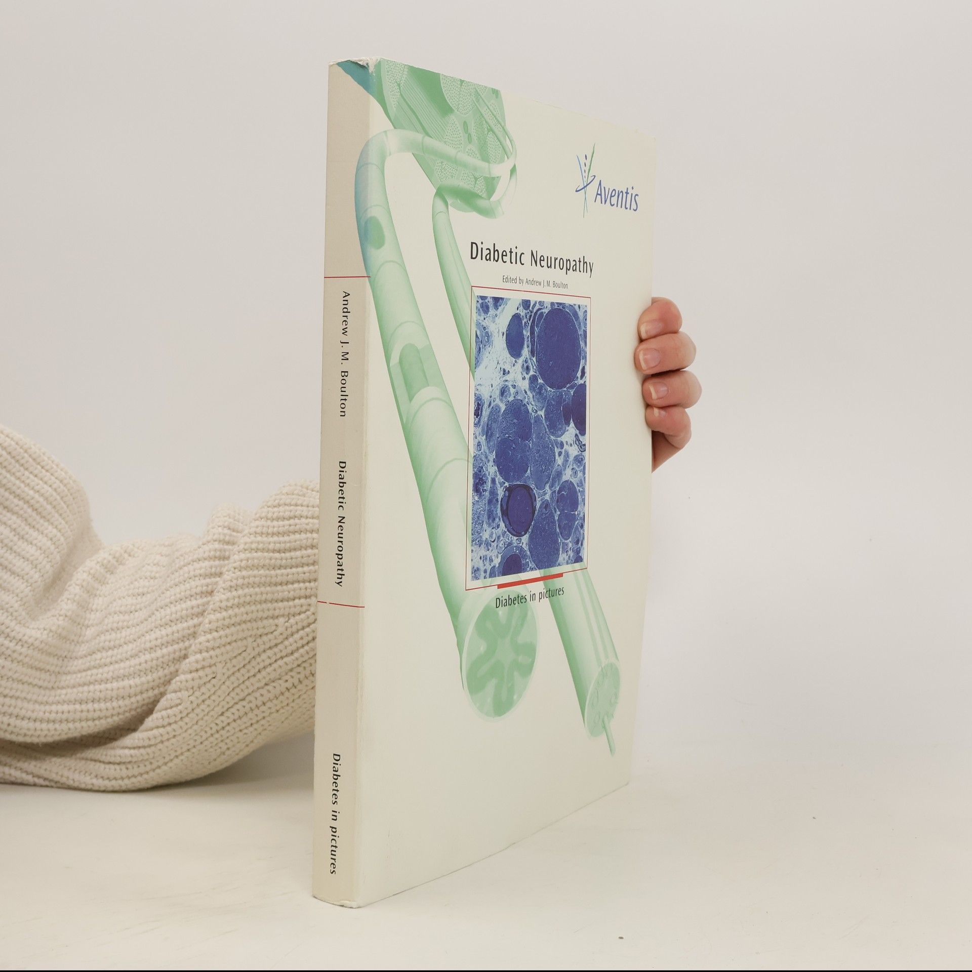 Andrew J. M Boulton Diabetic Neuropathy