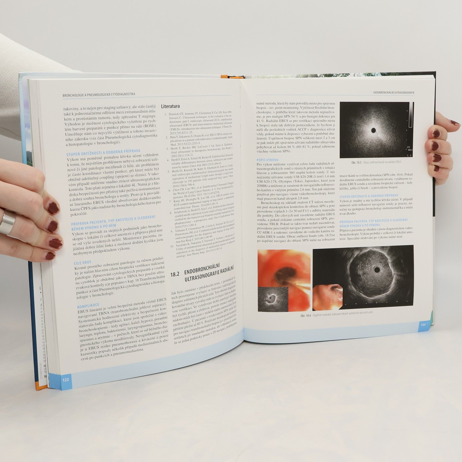 Martina Vašáková Bronchologie a pneumologická cytodiagnostika