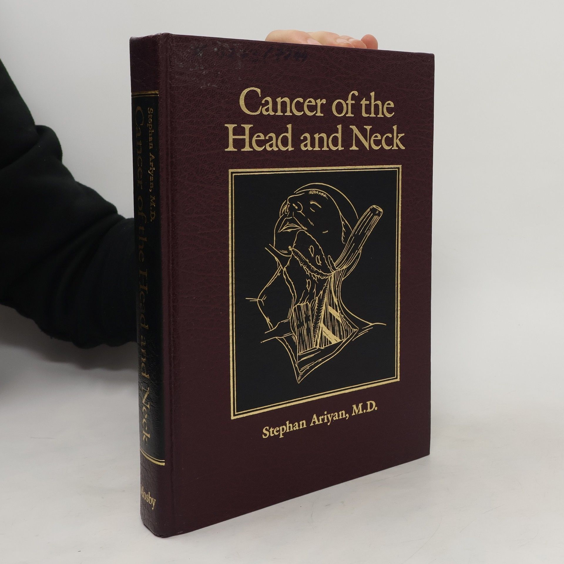 Stephan Ariyan Cancer of the head and neck