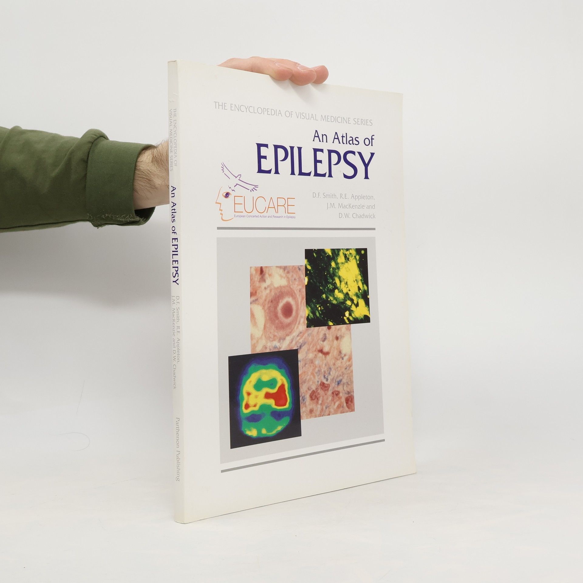 David F. Smith An Atlas of Epilepsy