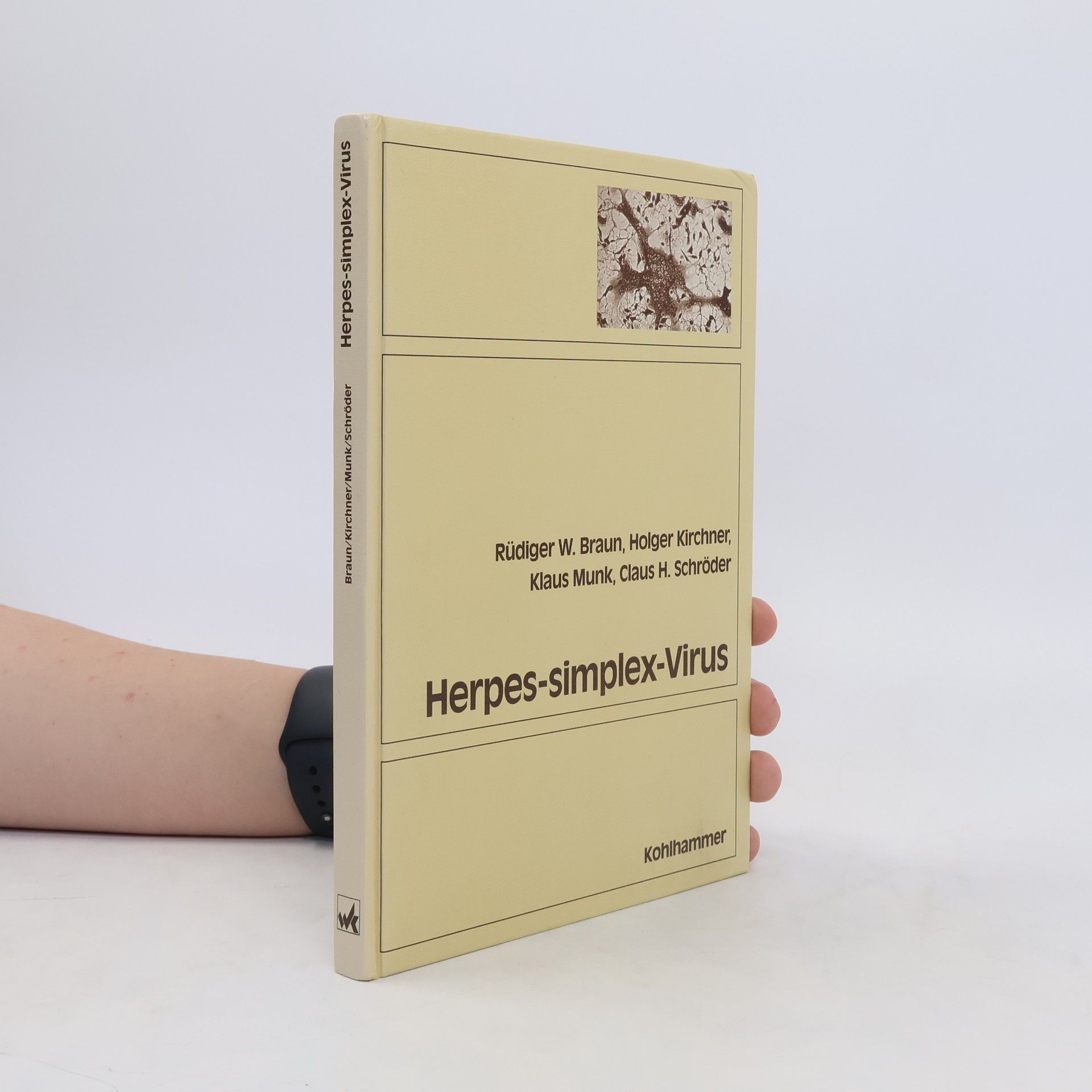 Rüdiger Braun Herpes-simplex-Virus