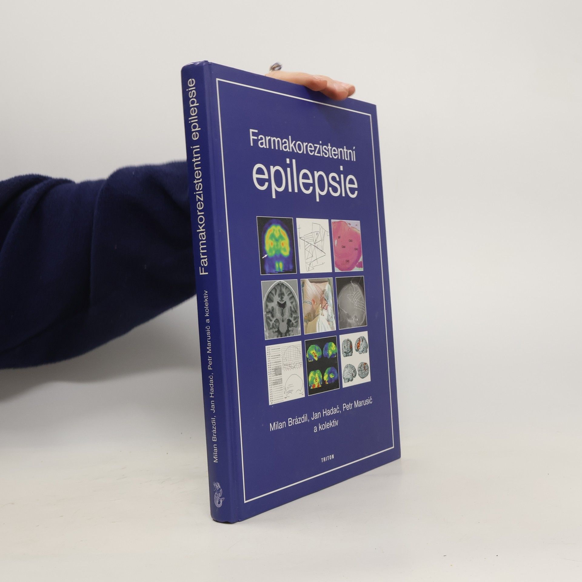 Kolektiv autorů Farmakorezistentní epilepsie