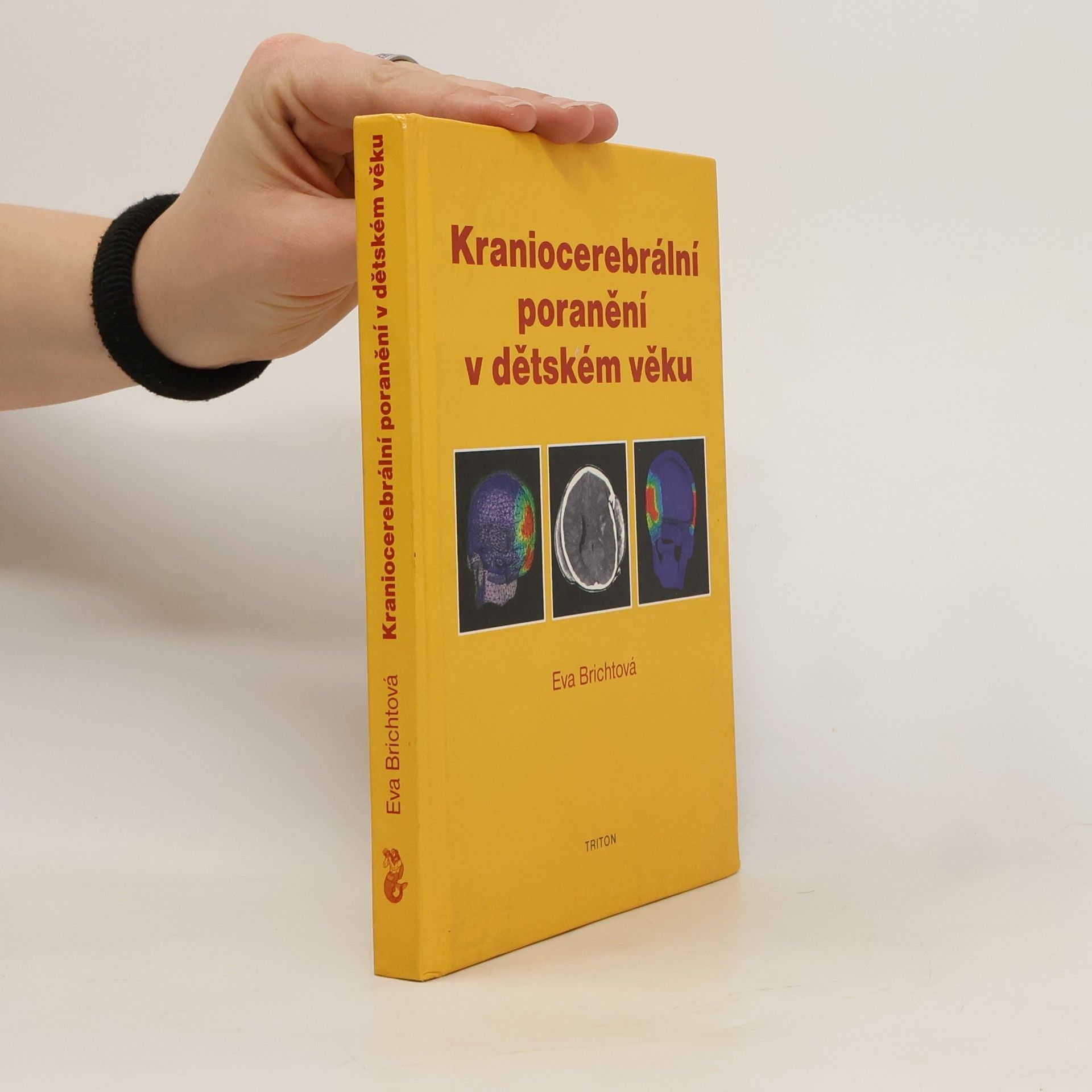 Eva Brichtová Kraniocerebrální poranění v dětském věku