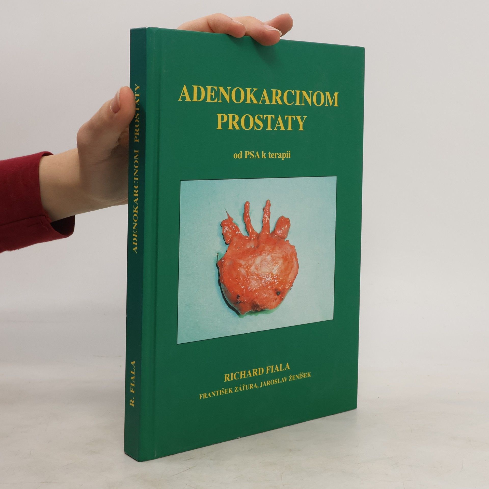 Richard Fiala Adenokarcinom prostaty od PSA k terapii