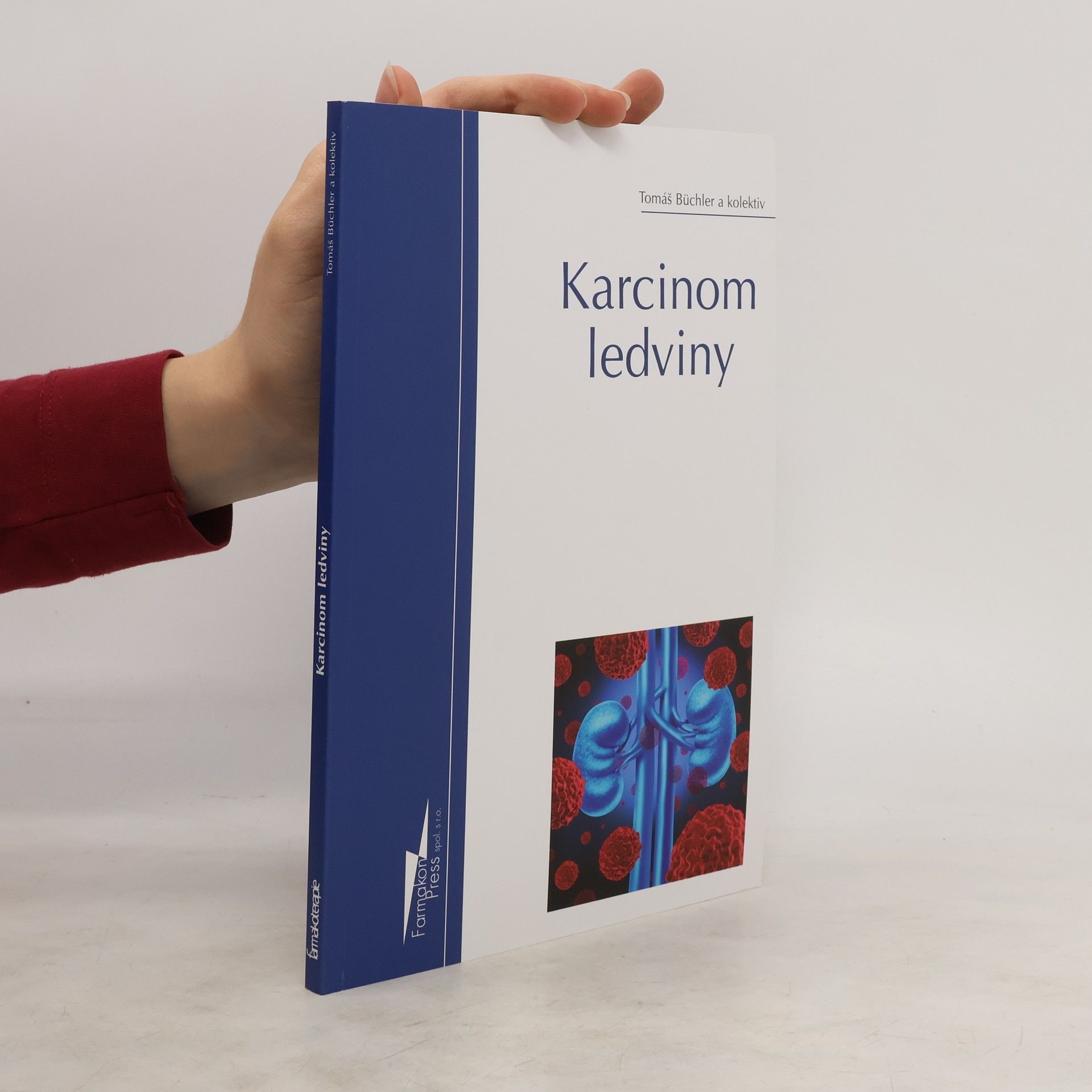 Tomas Buchler Karcinom ledviny