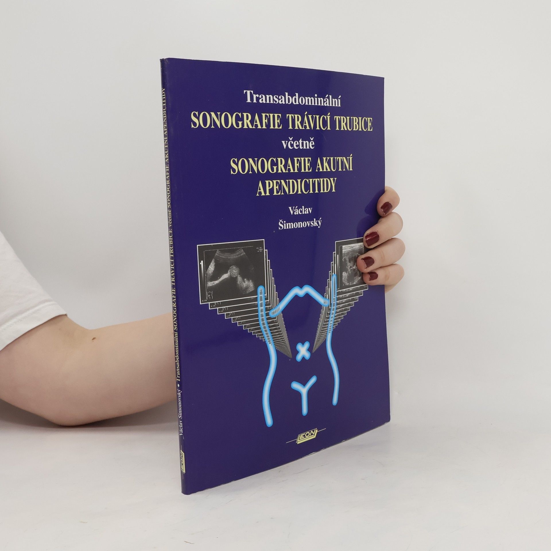 Václav Šimonovský Transabdominální sonografie trávicí trubice včetně sonografie akutní apendicitidy
