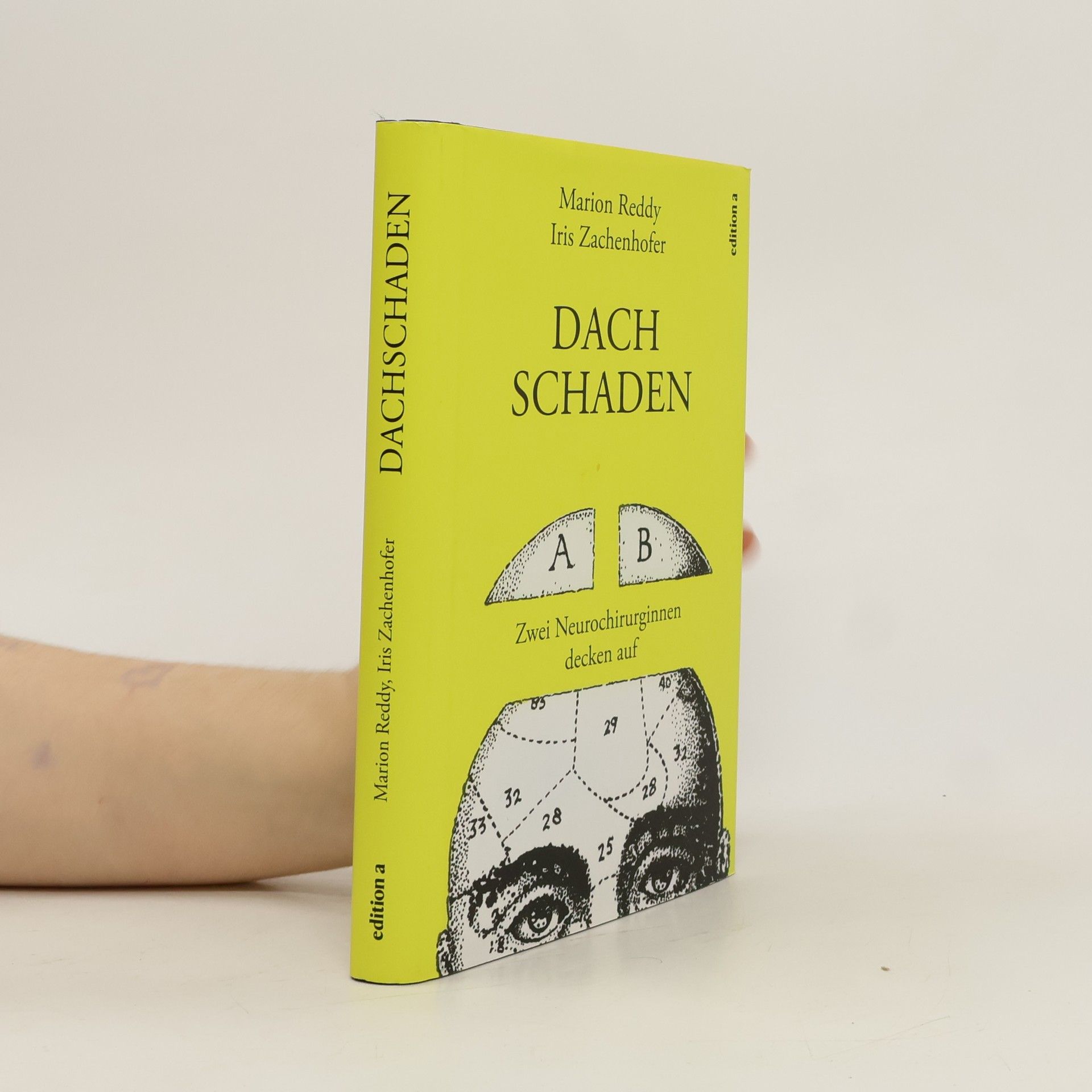 Marion Reddy Dachschaden
