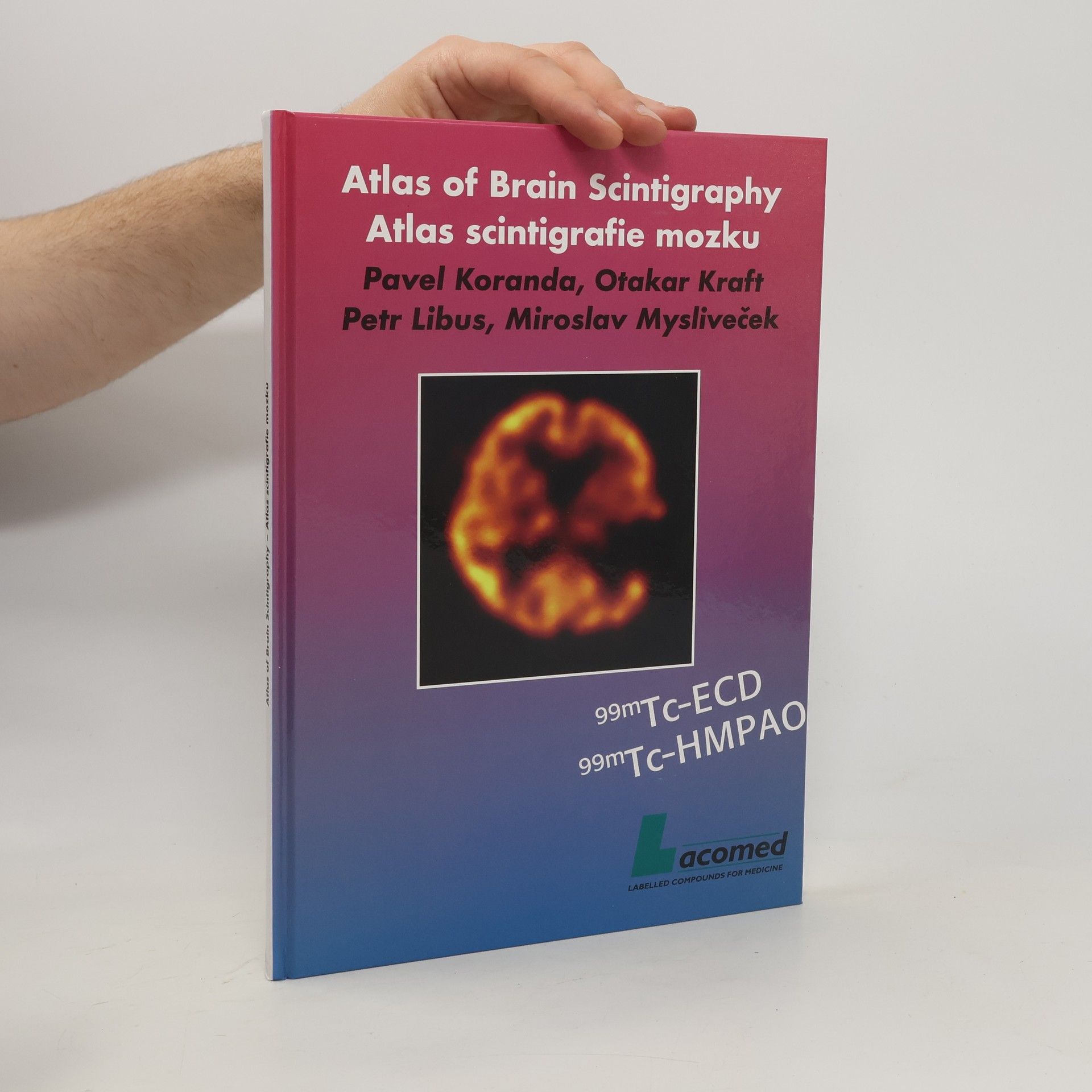 Collective Atlas scintigrafie mozku = Atlas of brain scintigraphy