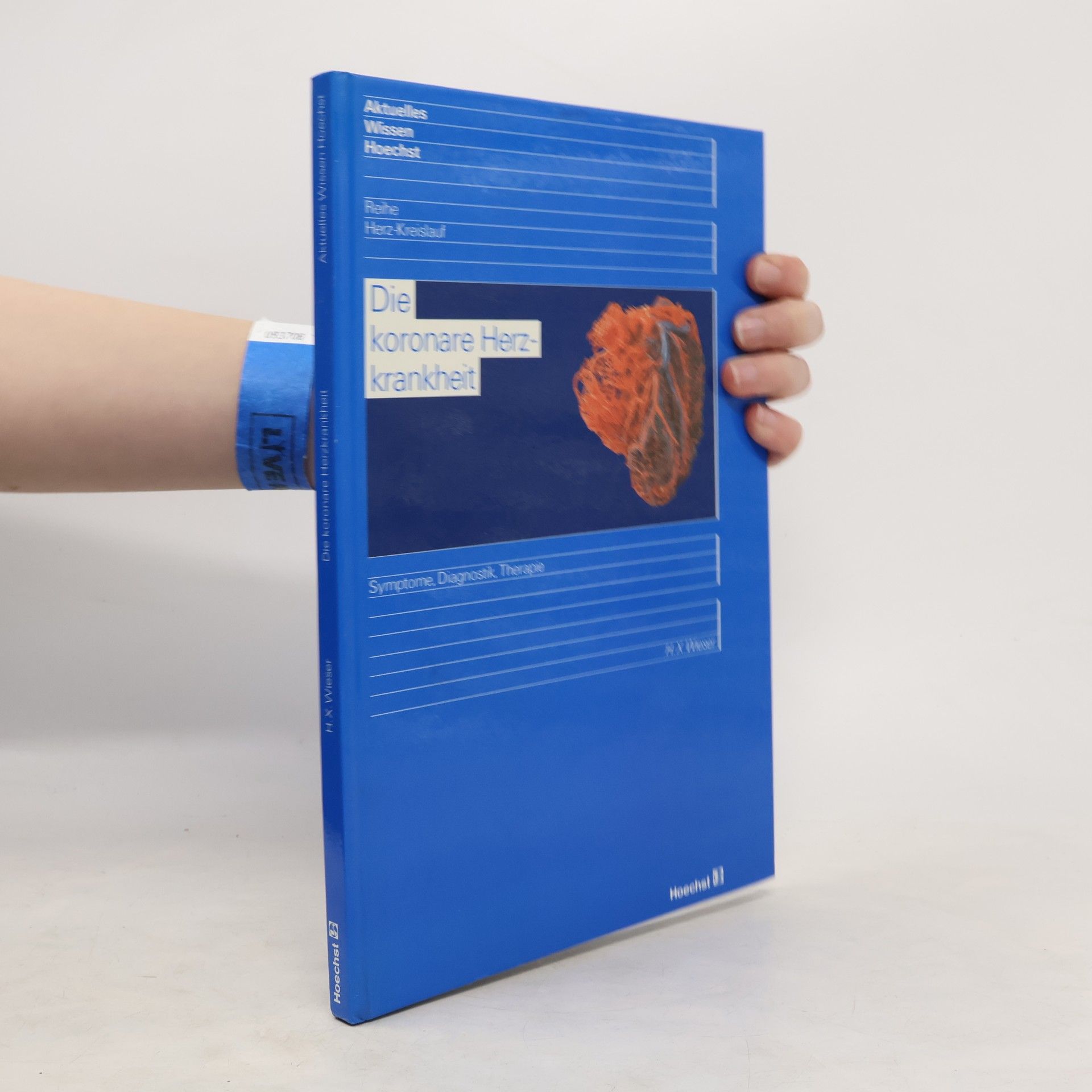 H. X. Wieser Die koronare Herzkrankheit. Symptome, Diagnostik, Therapie