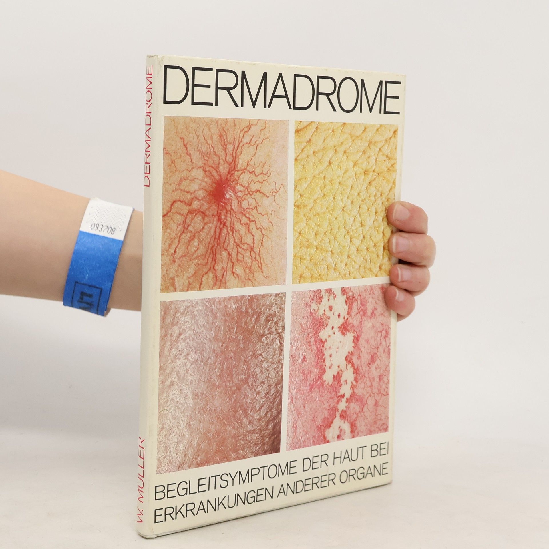 W. Müller Dermadrome