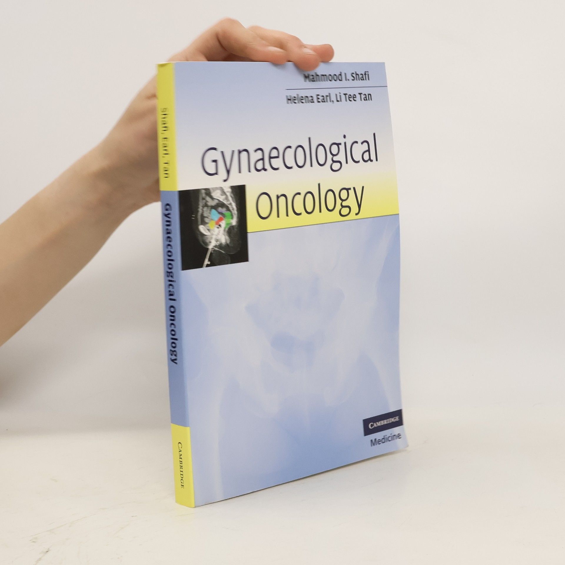 Mahmood Shaki Gynaecological Oncology