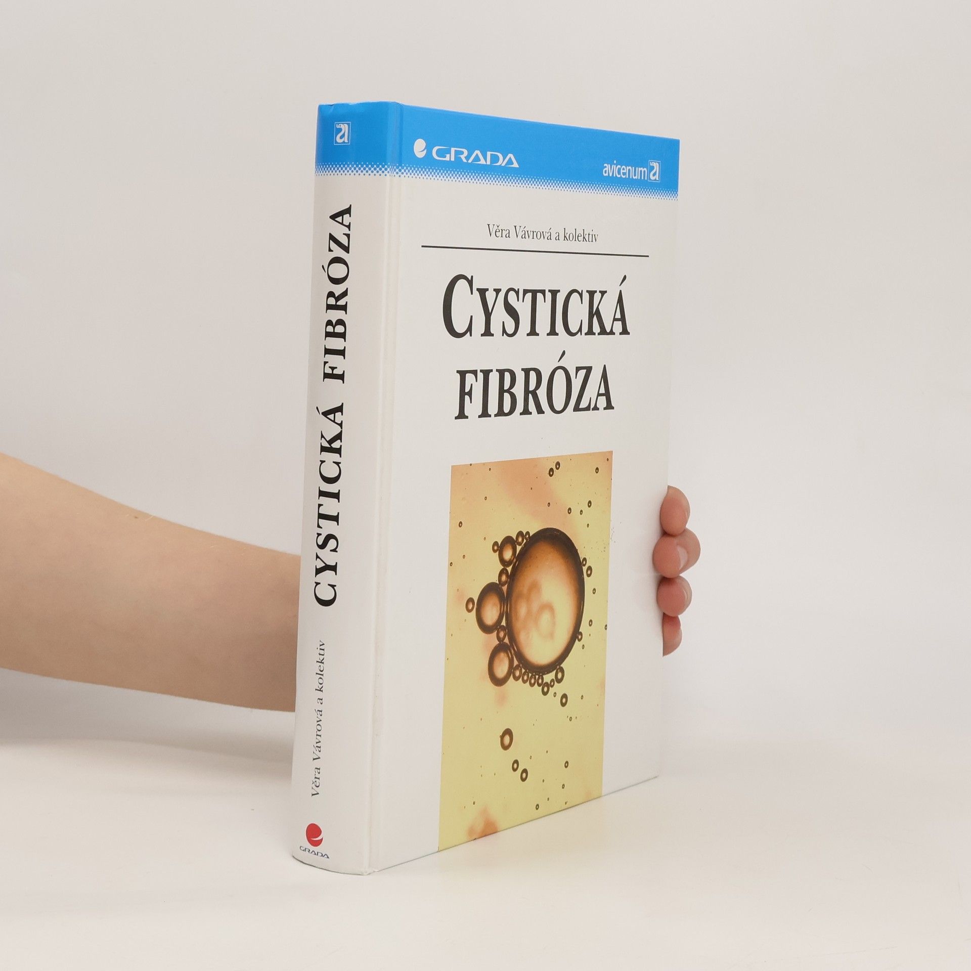 Věra Vávrová Cystická fibróza