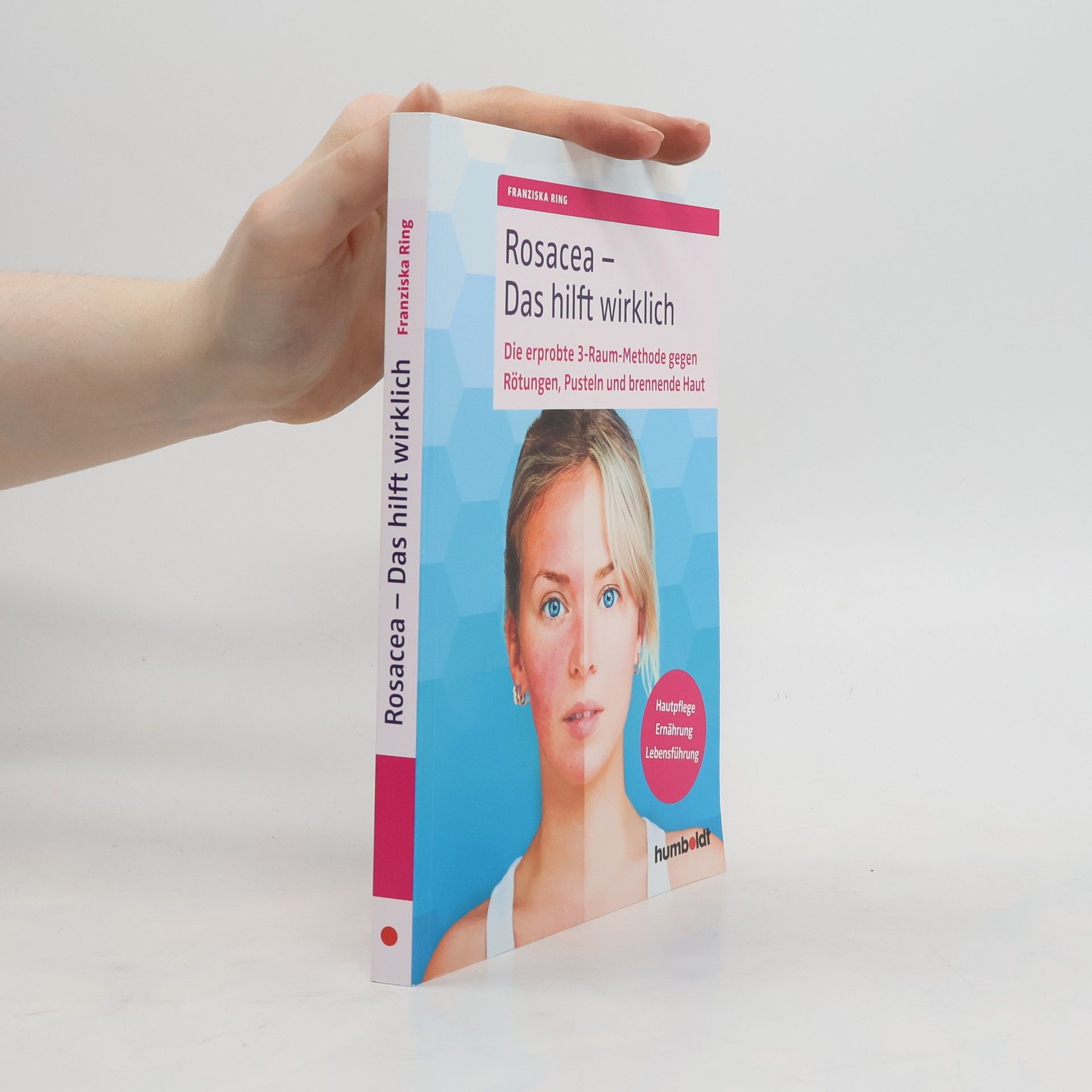 Franziska Ring Rosacea - das hilft wirklich