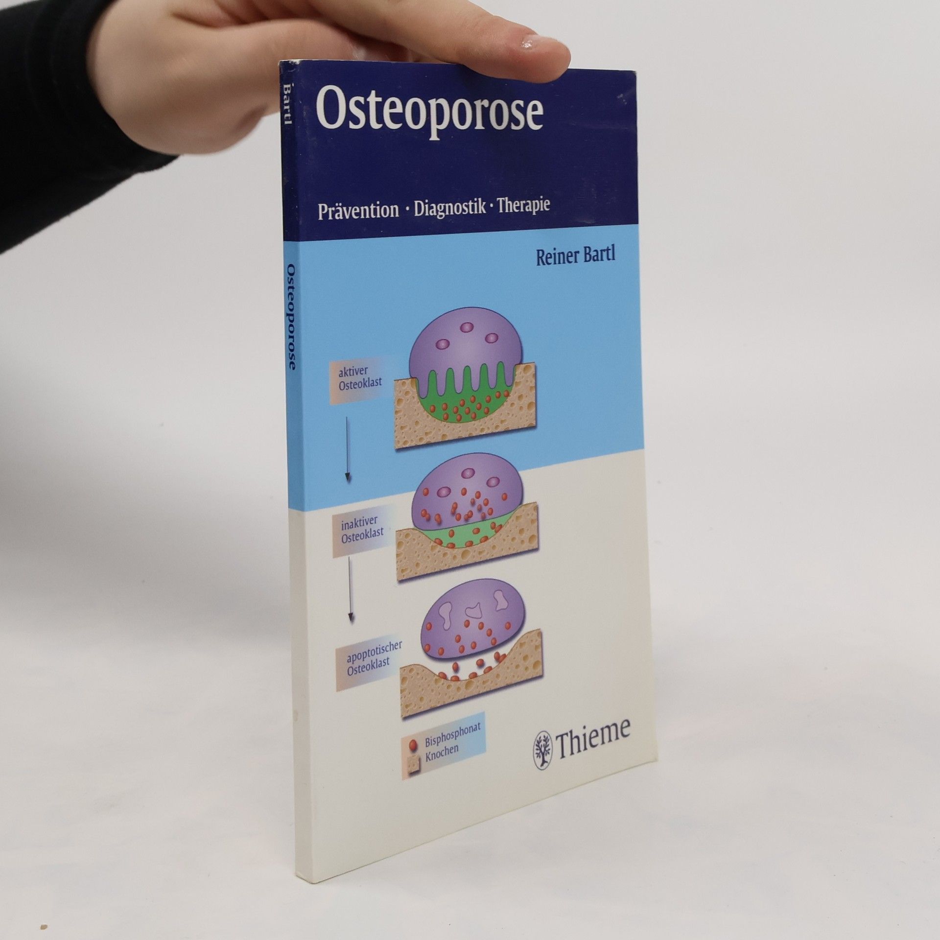 Reiner Bartl Osteoporose