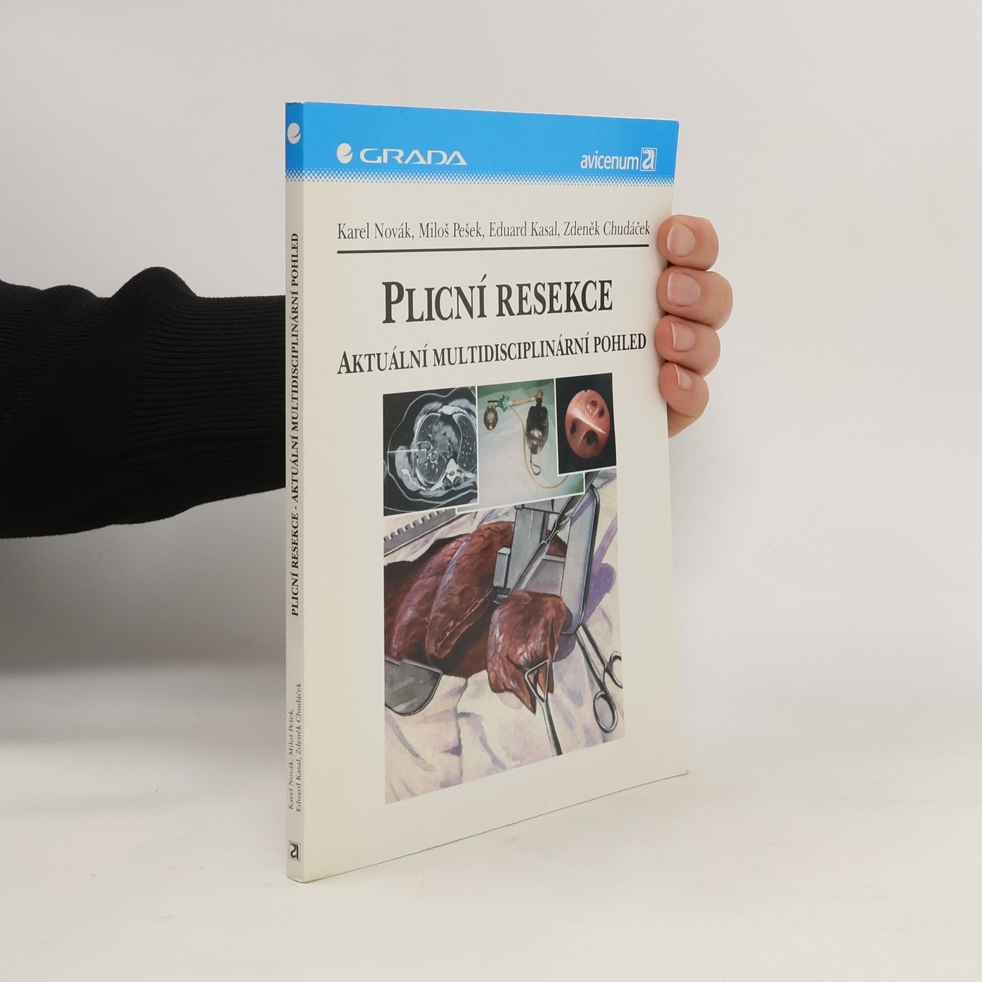 Karel Novák Plicní resekce : aktuální multidisciplinární pohled