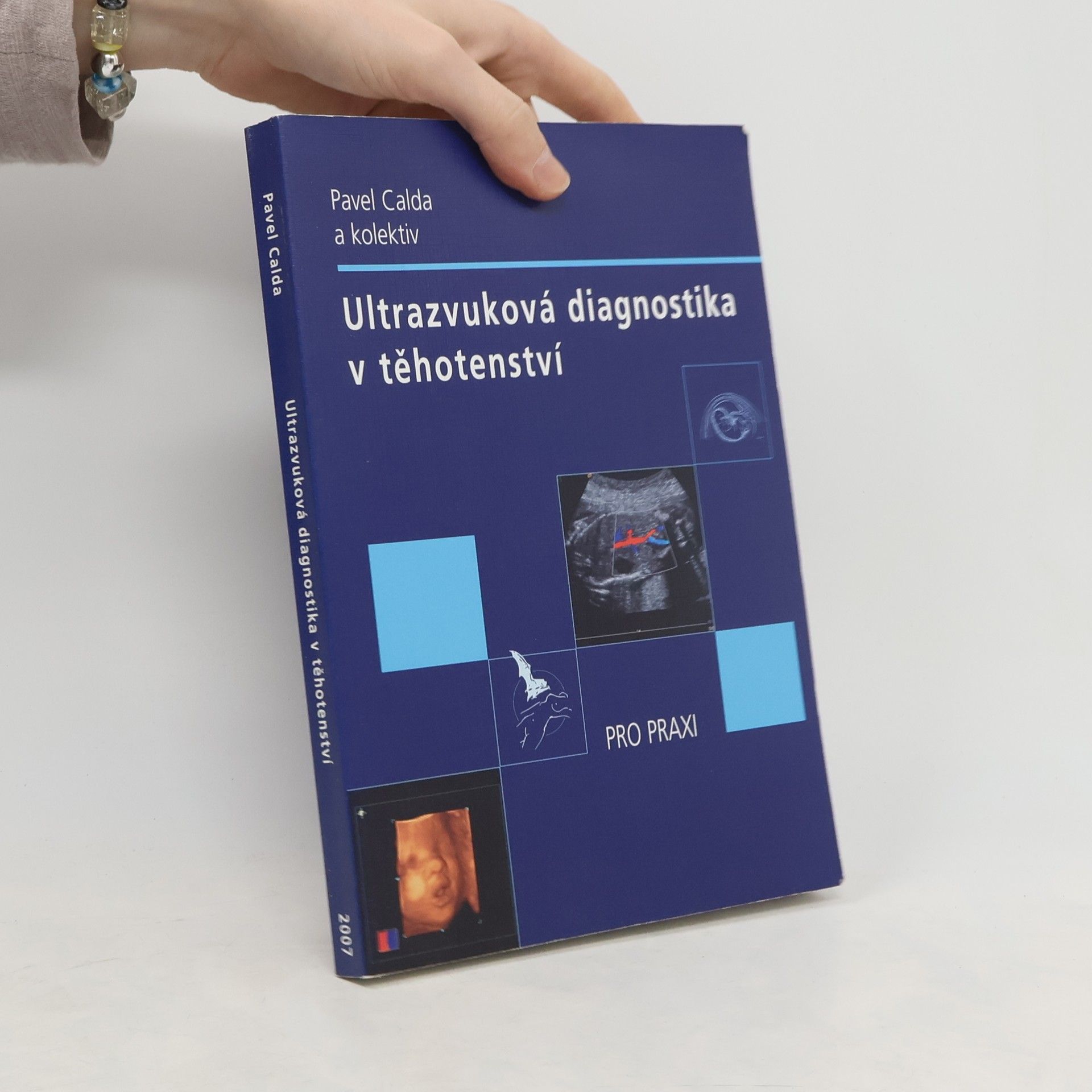 Pavel Calda Ultrazvuková diagnostika v těhotenství