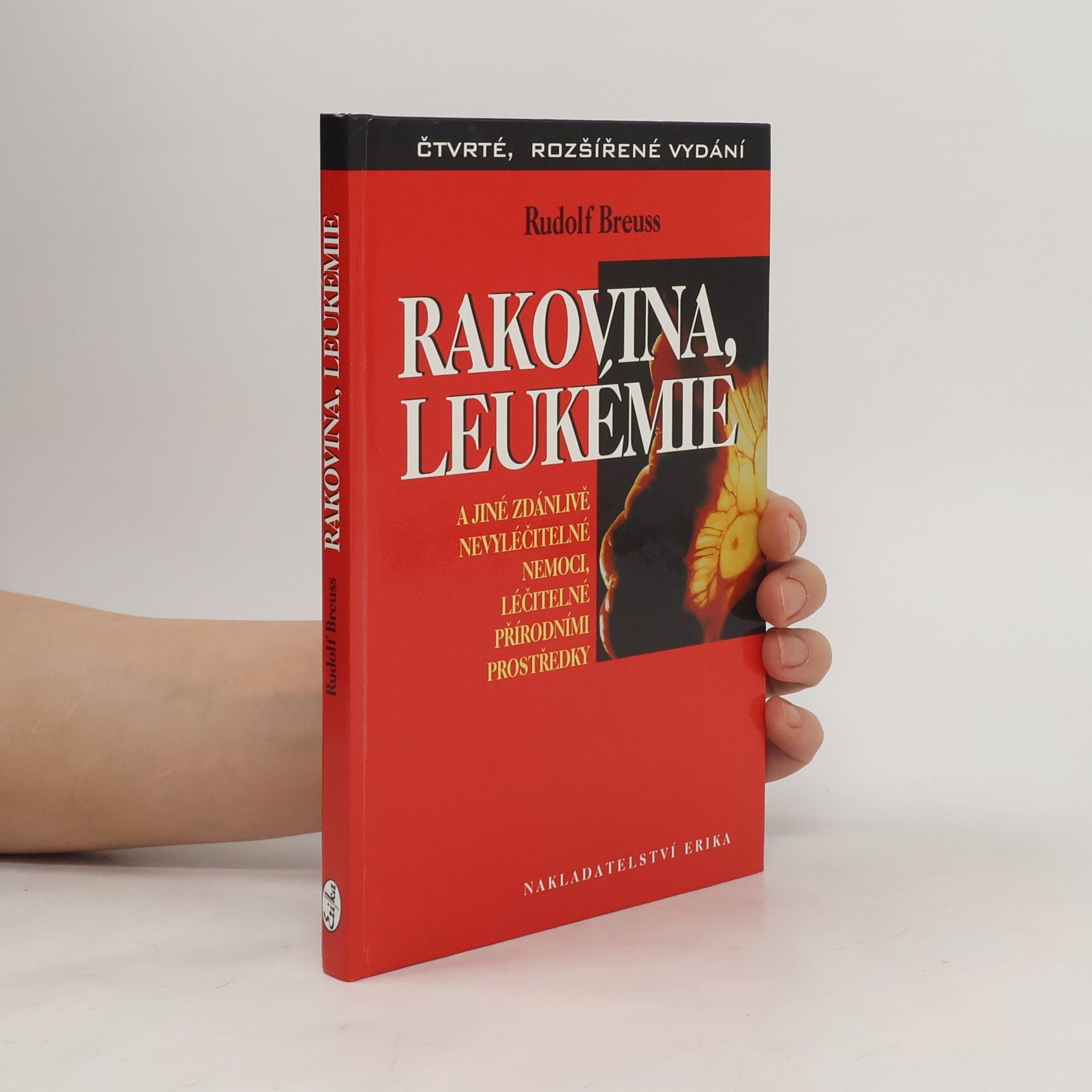 Rudolf Breuss Rakovina, leukémie a jiné zdánlivě nevyléčitelné nemoci, léčitelné přírodními prostředky