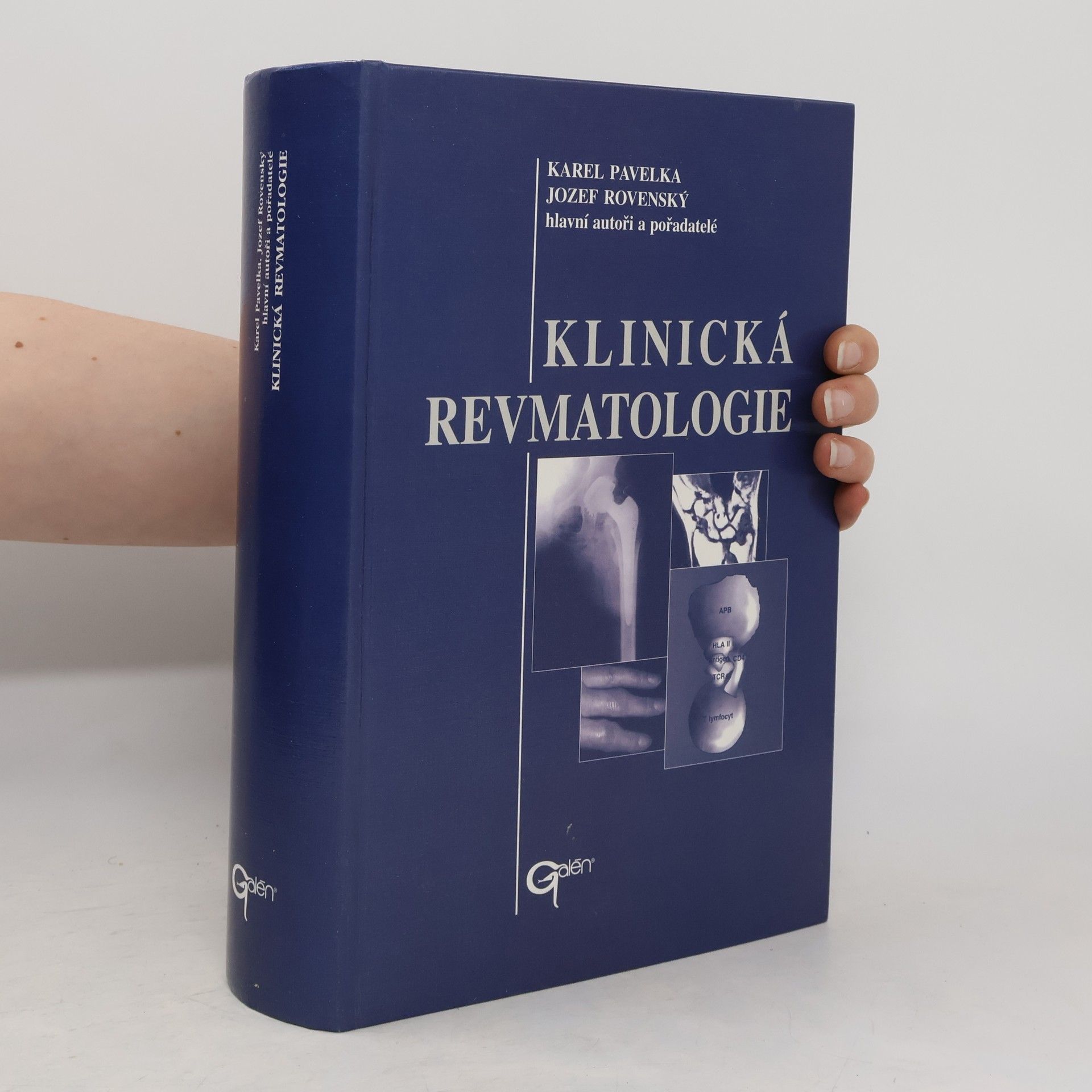 Karel Pavelka Klinická revmatologie