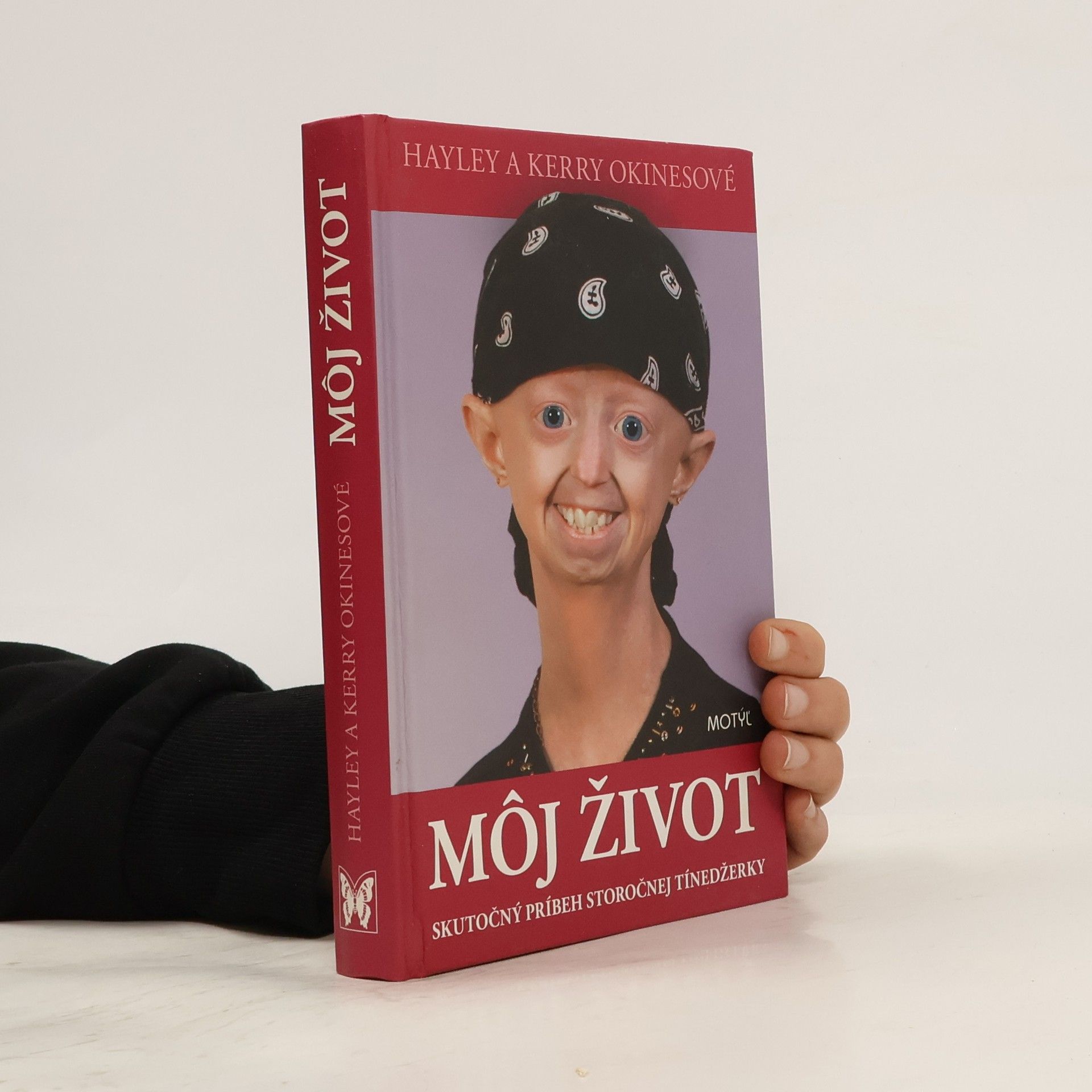 Hayley Okines Môj život