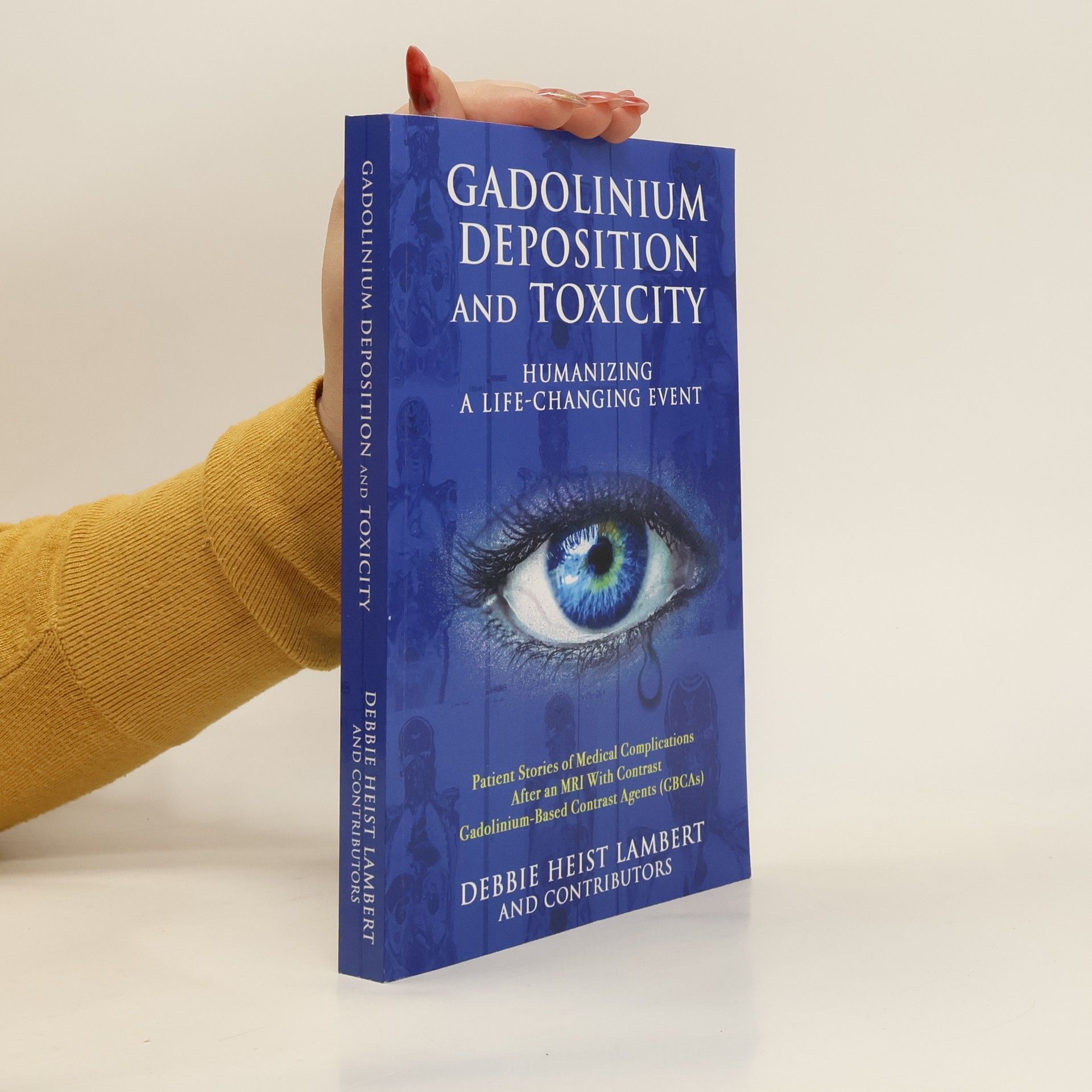 Debbie Heist Lambert Gadolinium Deposition and Toxicity