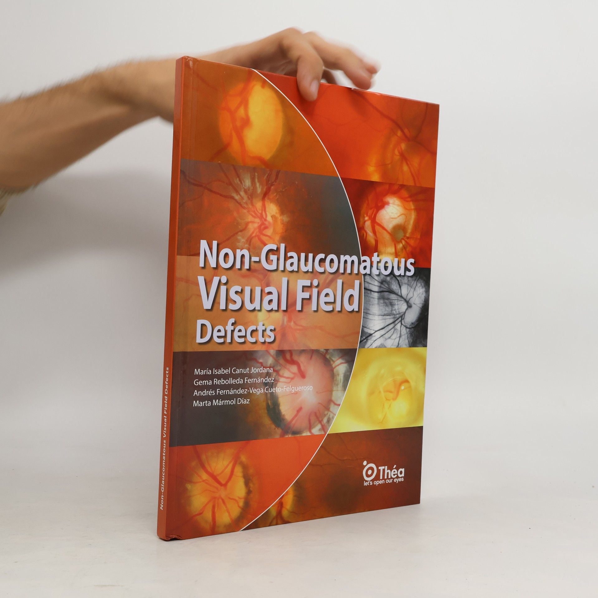 Various authors Non-Glaucomatous Visual Field Defects