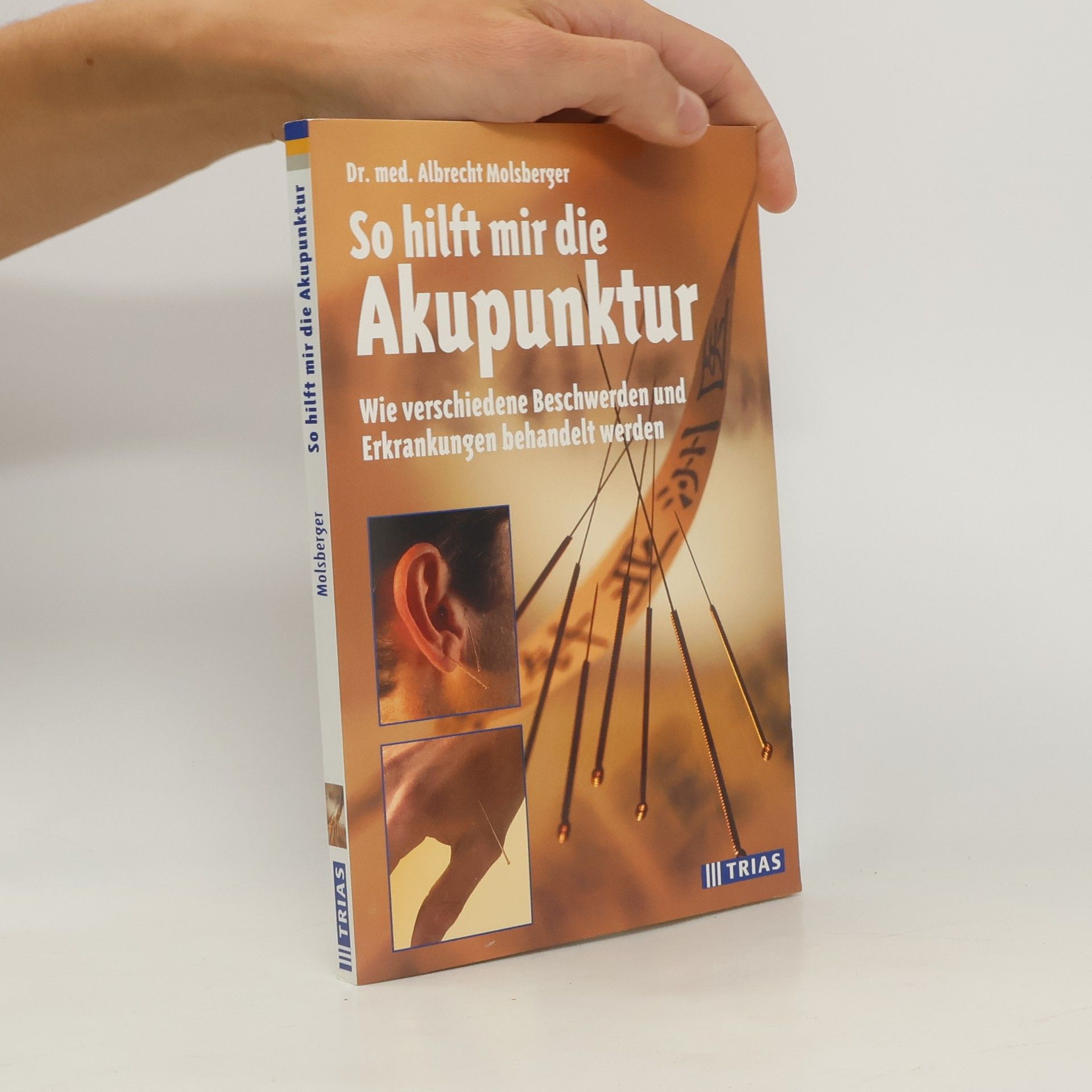 Albrecht Molsberger So hilft mir die Akupunktur