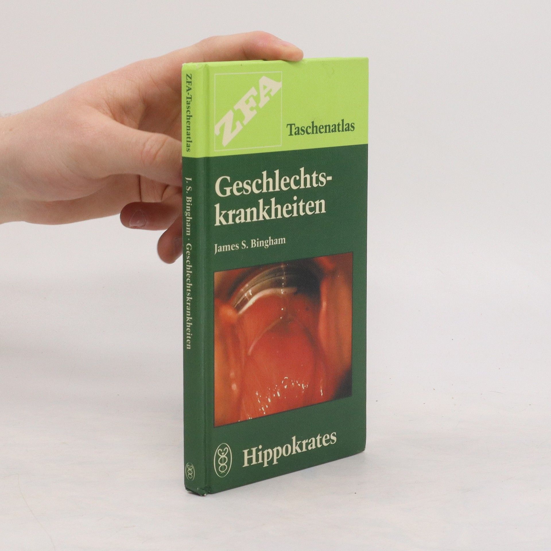 James S. Bingham Geschlechtskrankheiten