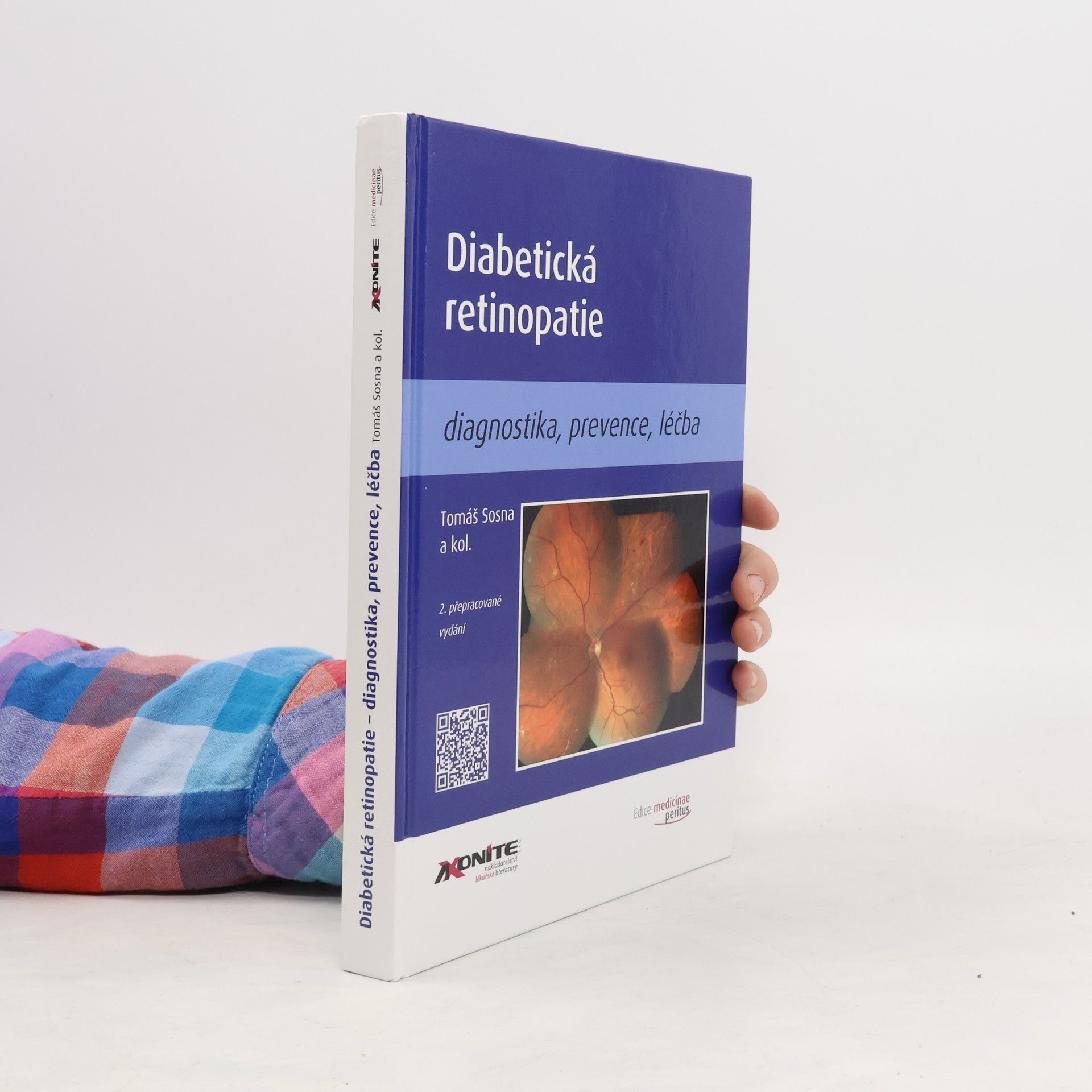 Tomáš Sosna Diabetická retinopatie