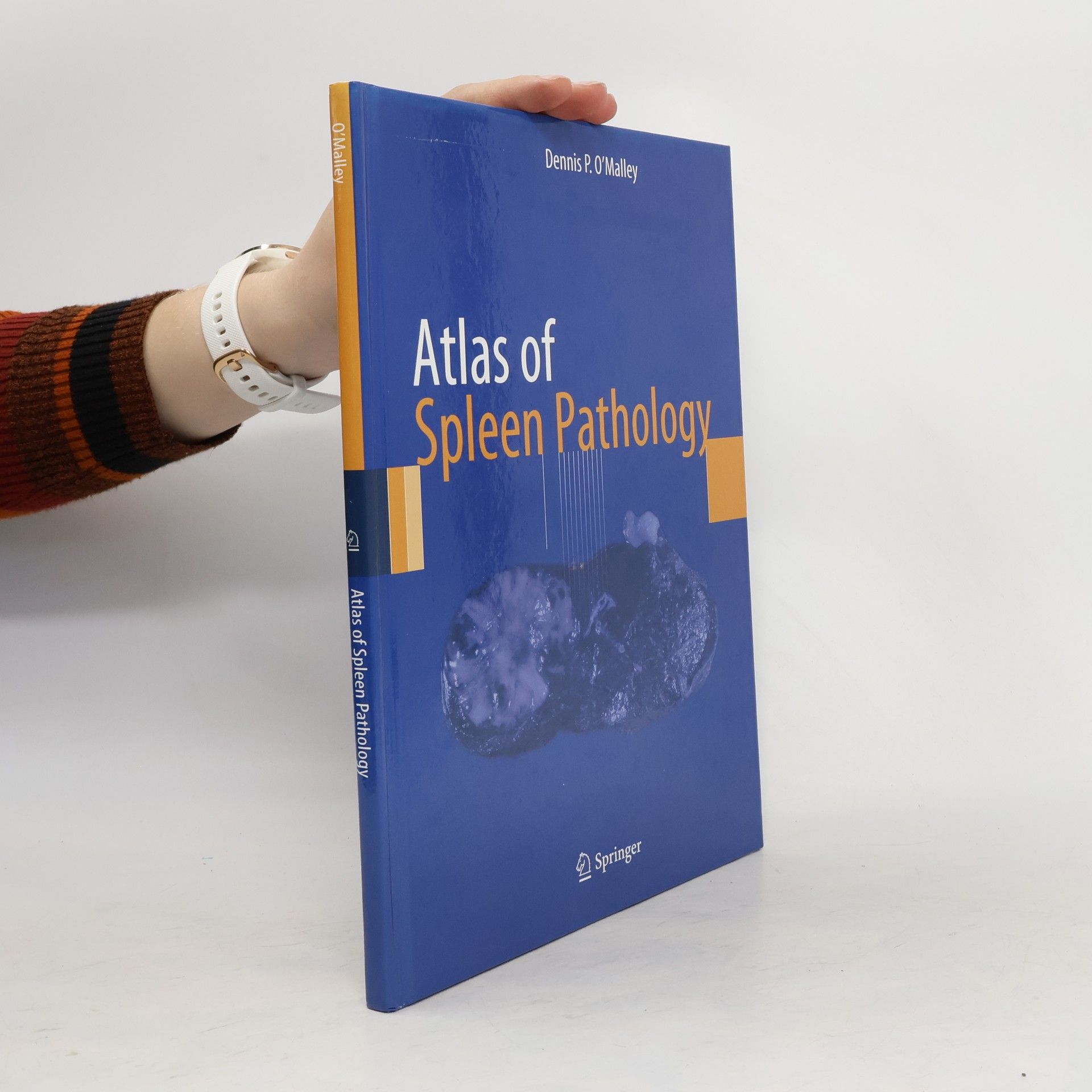 Dennis P. O. Malley Atlas of Spleen Pathology