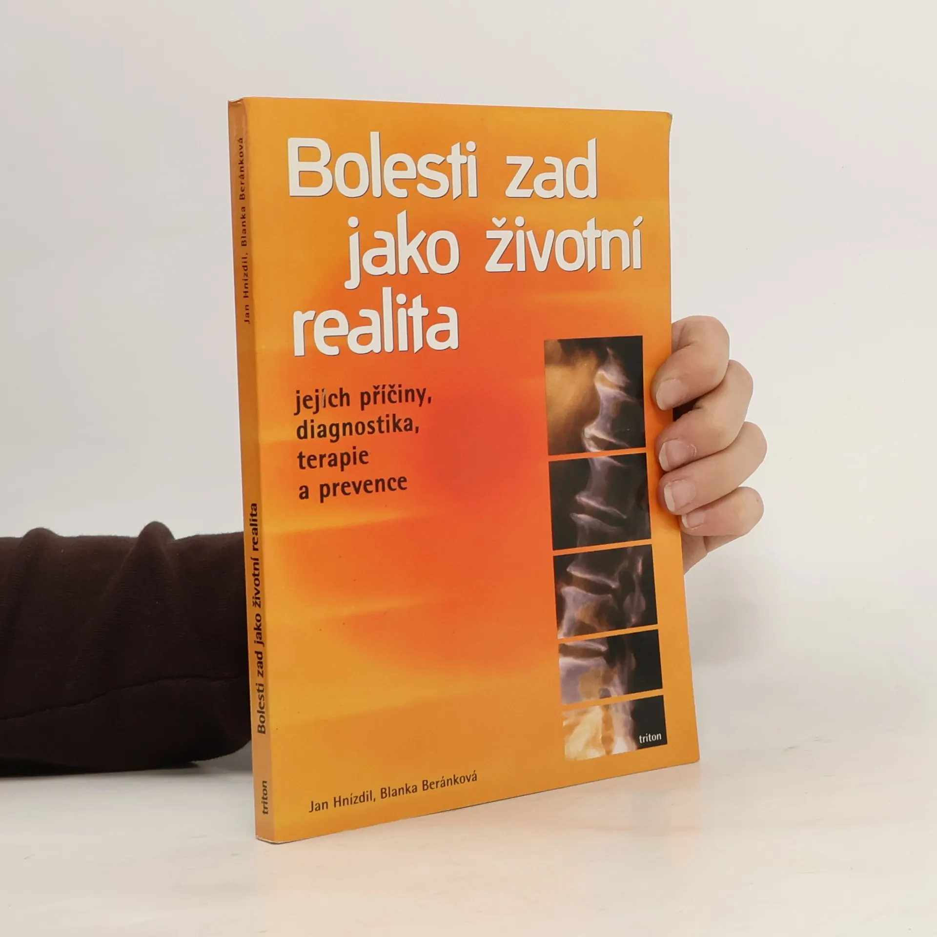 Bolesti zad jako životní realita. Jejich příčiny, diagnostika, terapie a prevence | Kniha | mäkká | Jan Hnízdil | CS