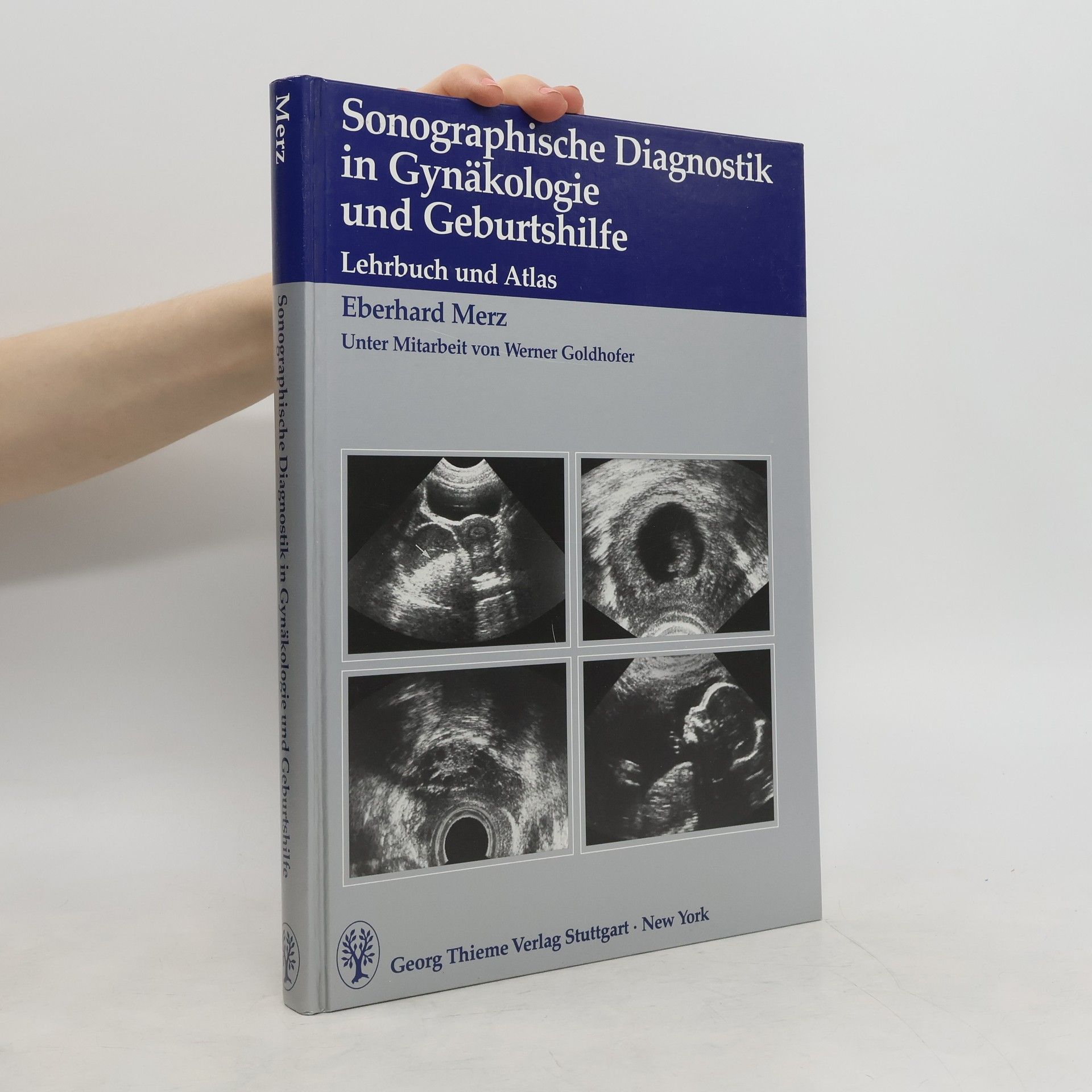 Eberhard Merz Sonographische Diagnostik in Gynäkologie und Geburtshilfe