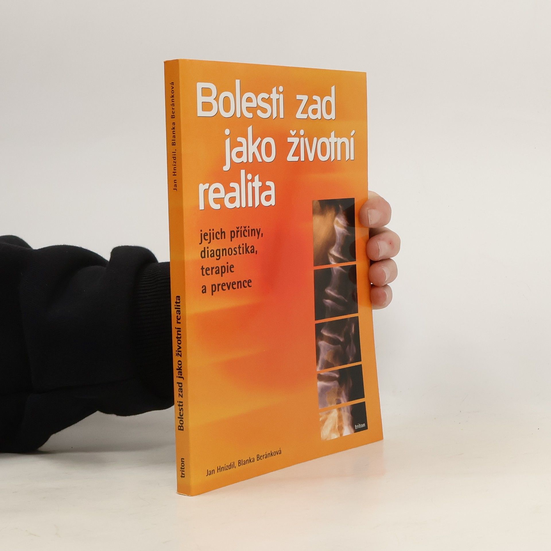 Jan Hnízdil Bolesti zad jako životní realita. Jejich příčiny, diagnostika, terapie a prevence