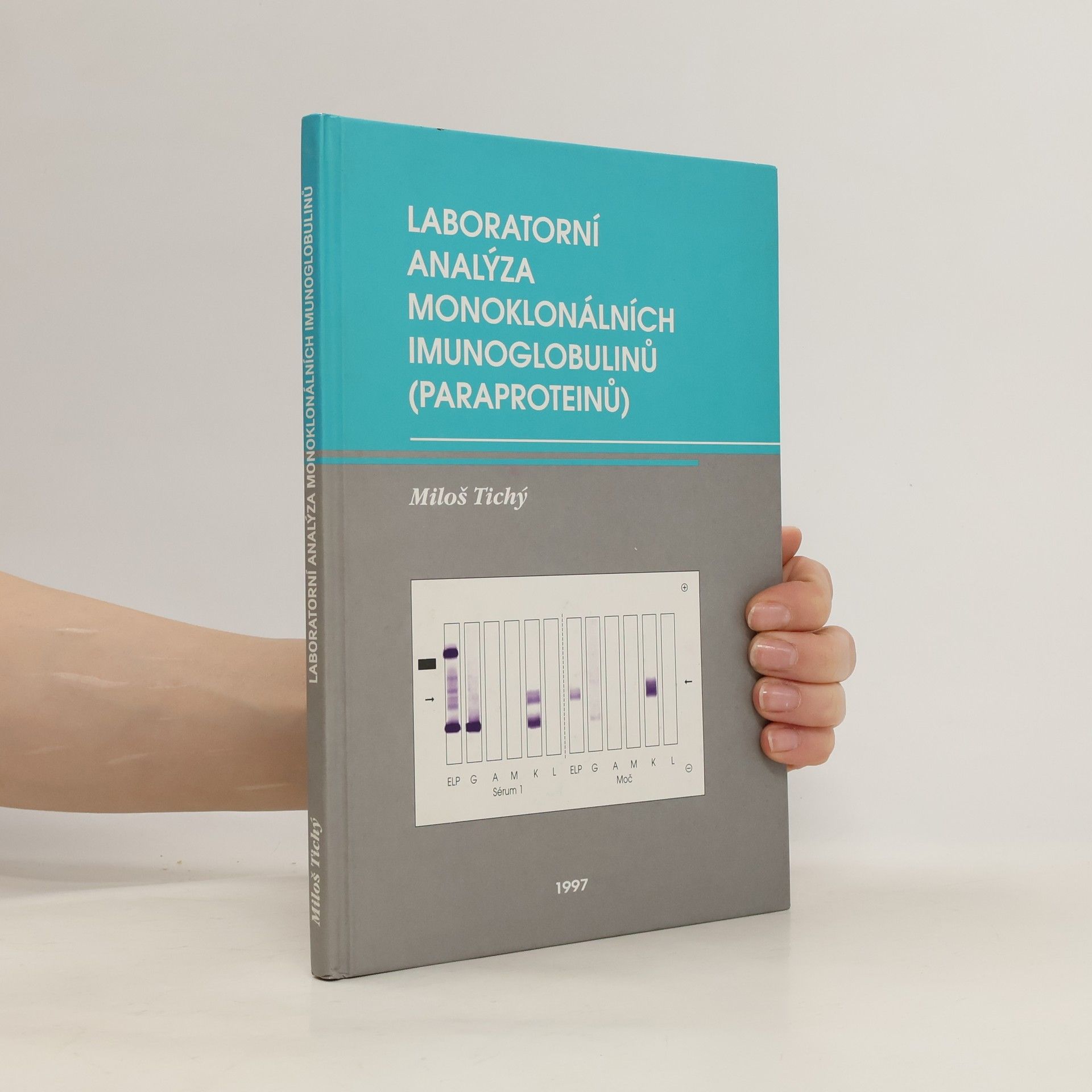 Miloš Tichý Laboratorní analýza monoklonálních imunoglobulinů (paraproteinů)