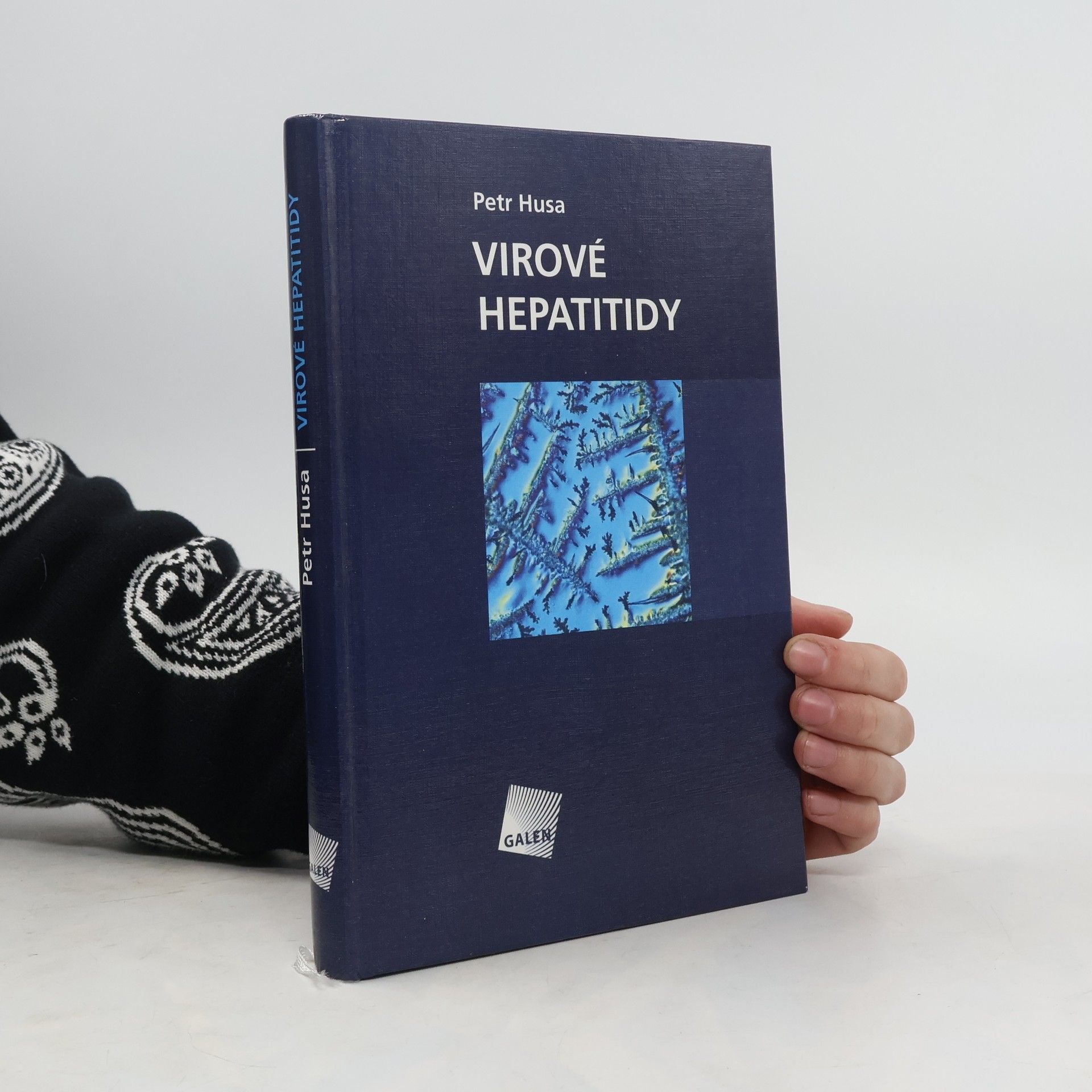 Petr Husa Virové hepatitidy
