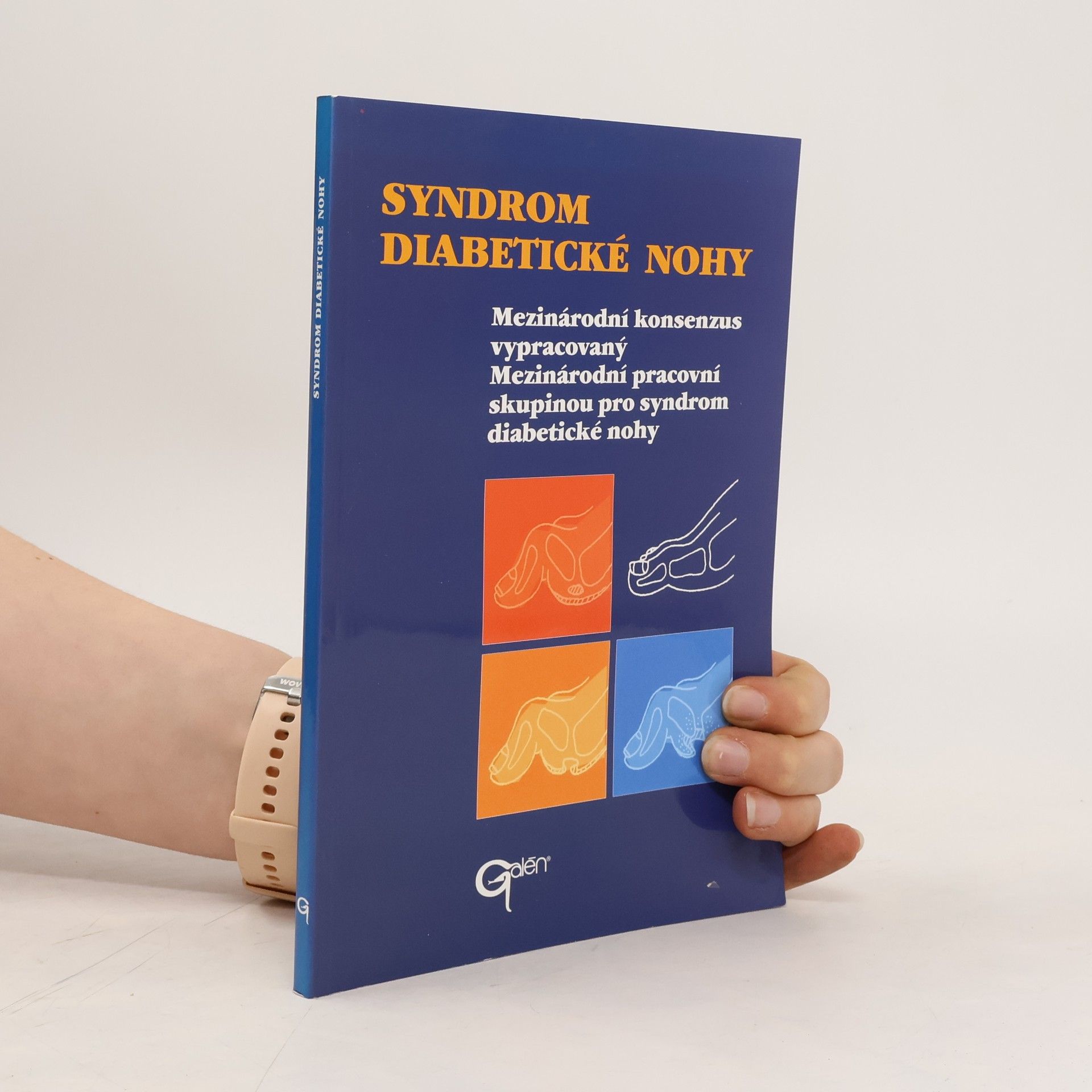 Auteurscollectief Syndrom diabetické nohy