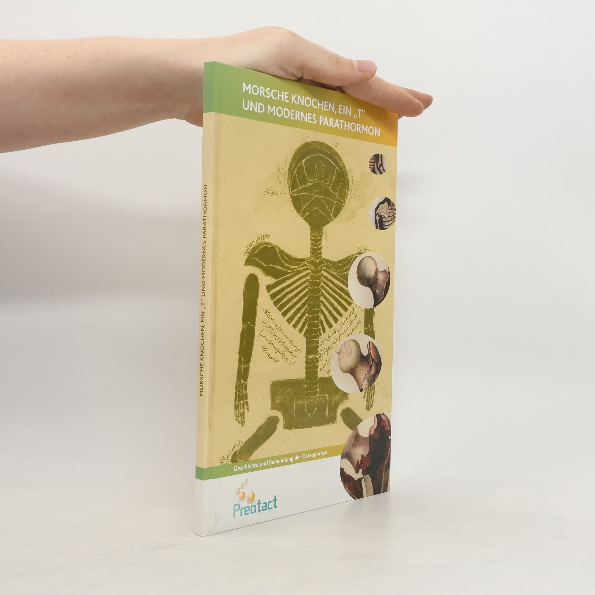 Auteurscollectief Morsche Knochen, ein ,,T” und modernes Parathormon