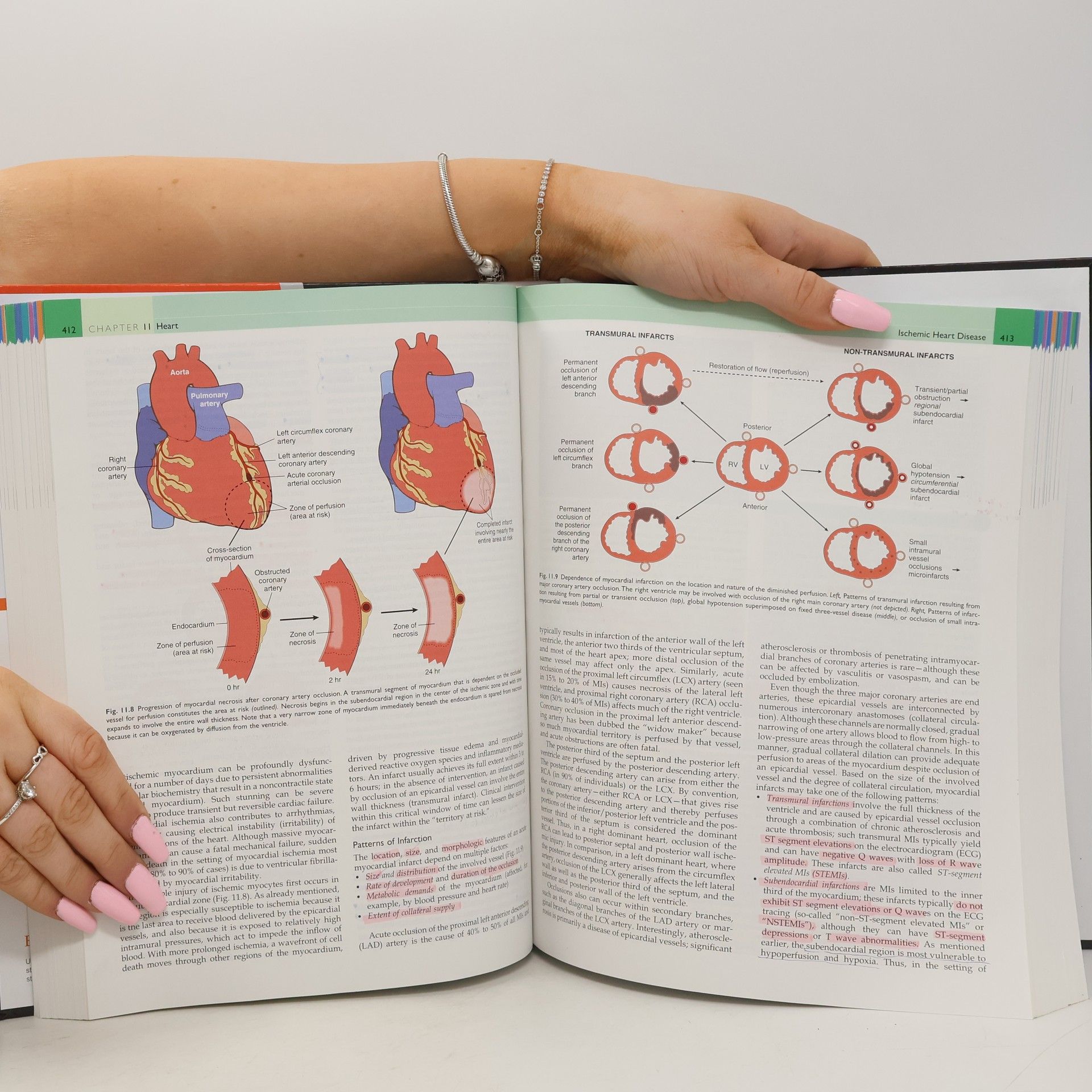Viay Kumar Robbins Basic Pathology