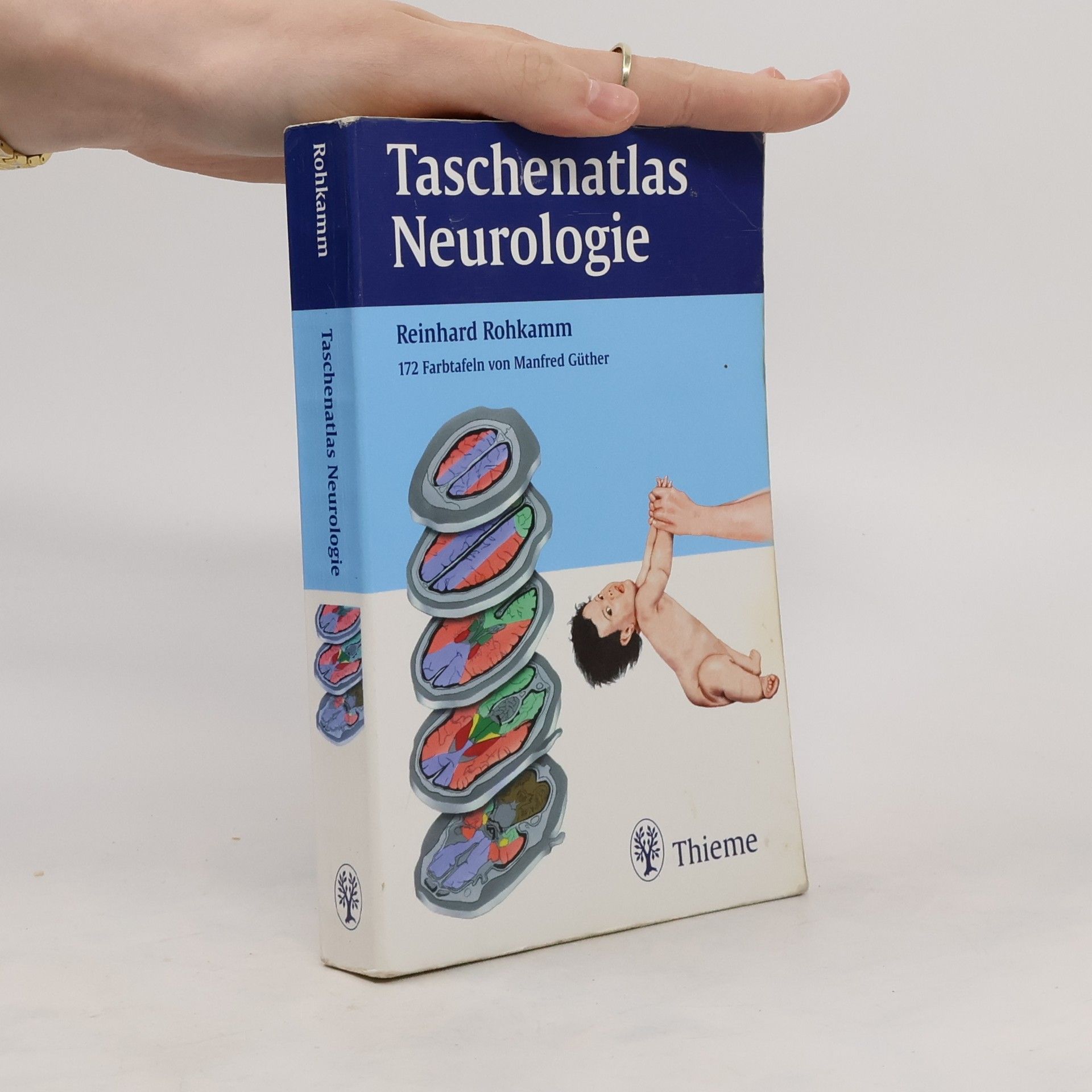 Reinhard Rohkamm Taschenatlas Neurologie
