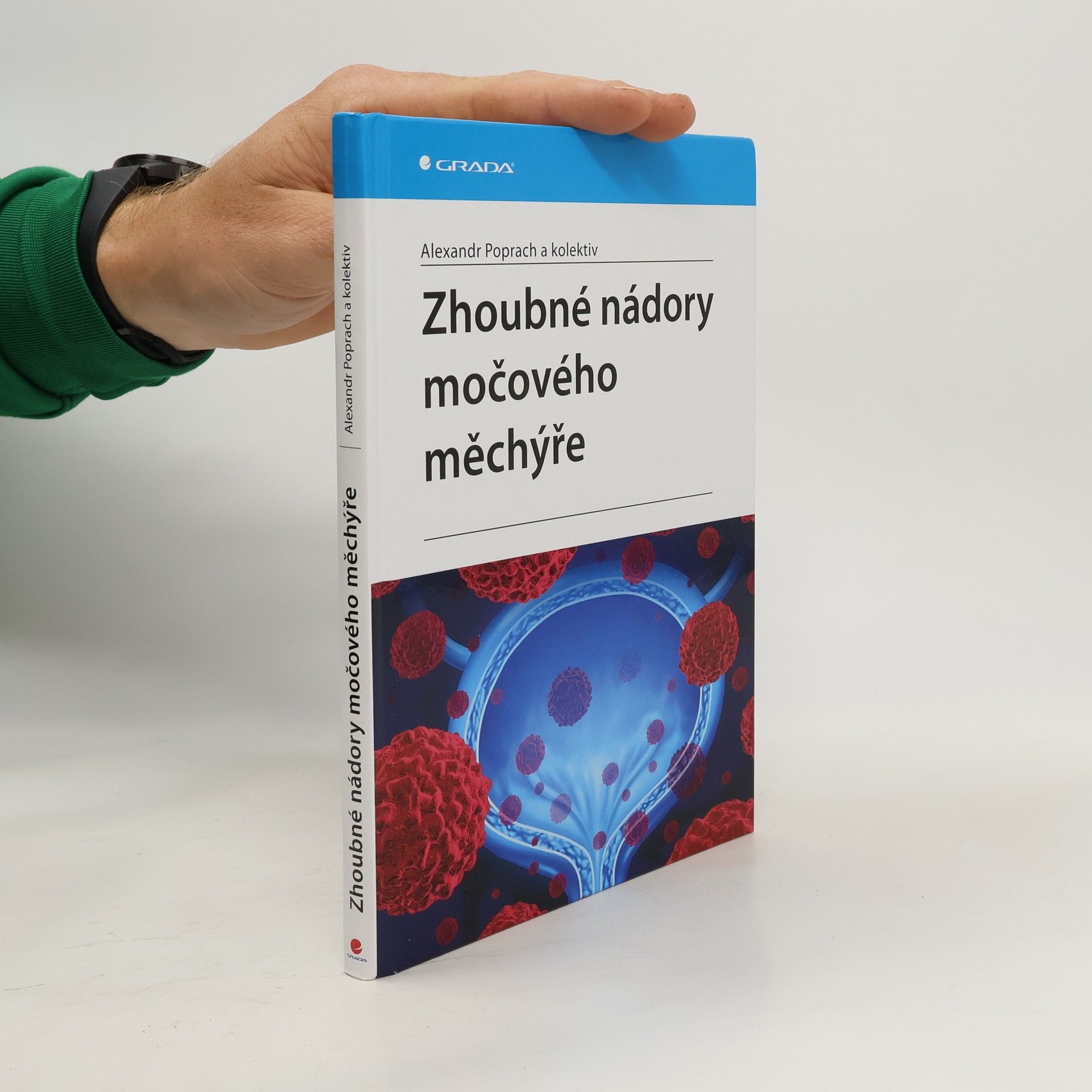 Alexandr Poprach Zhoubné nádory močového měchýře