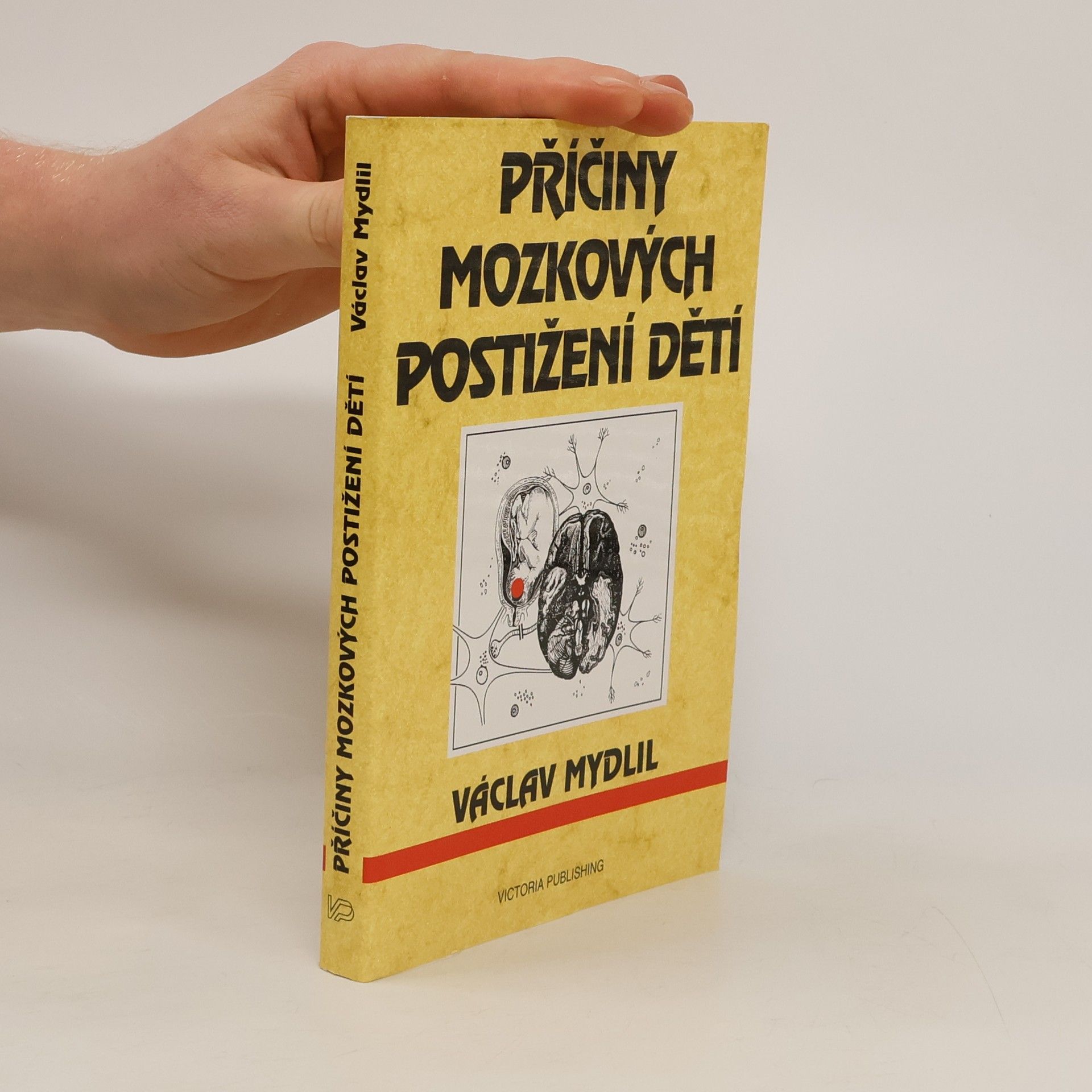 Václav Mydlil Příčiny mozkových postižení dětí