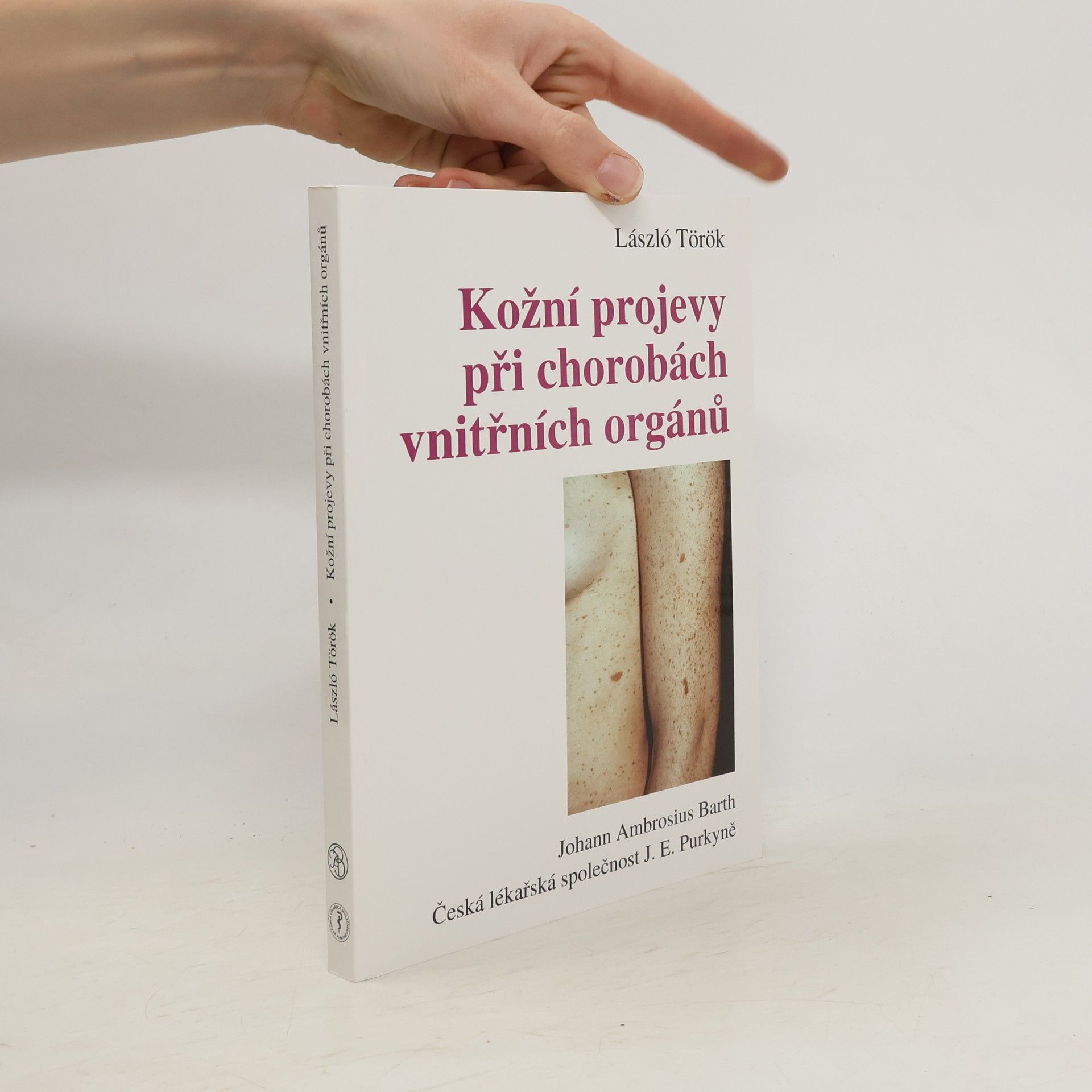 László Török Kožní projevy při chorobách vnitřních orgánů