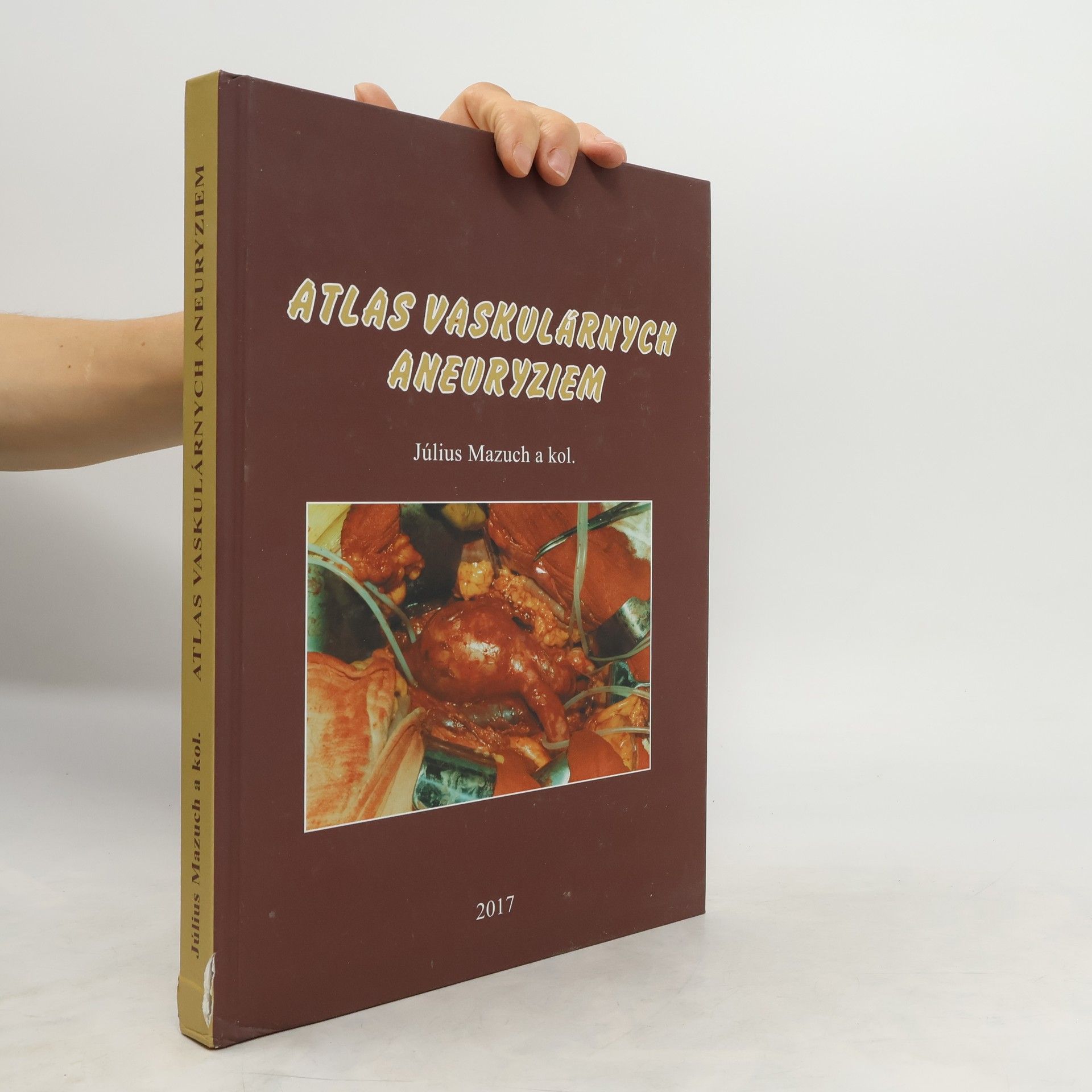 Július Mazuch Atlas vaskulárnych aneuryziem