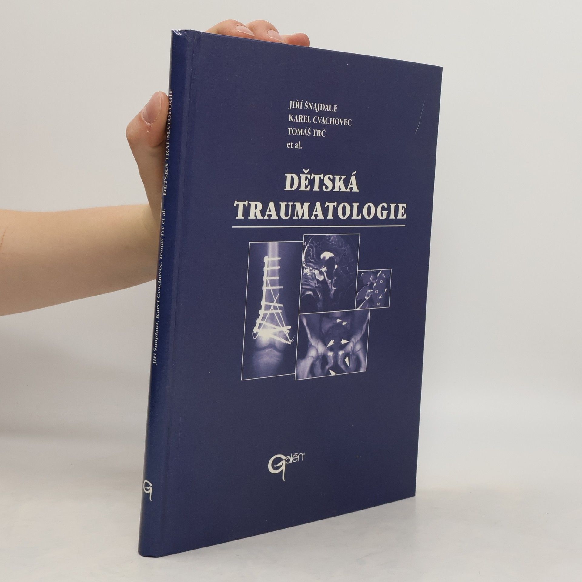 Jiří Šnajdauf Dětská traumatologie