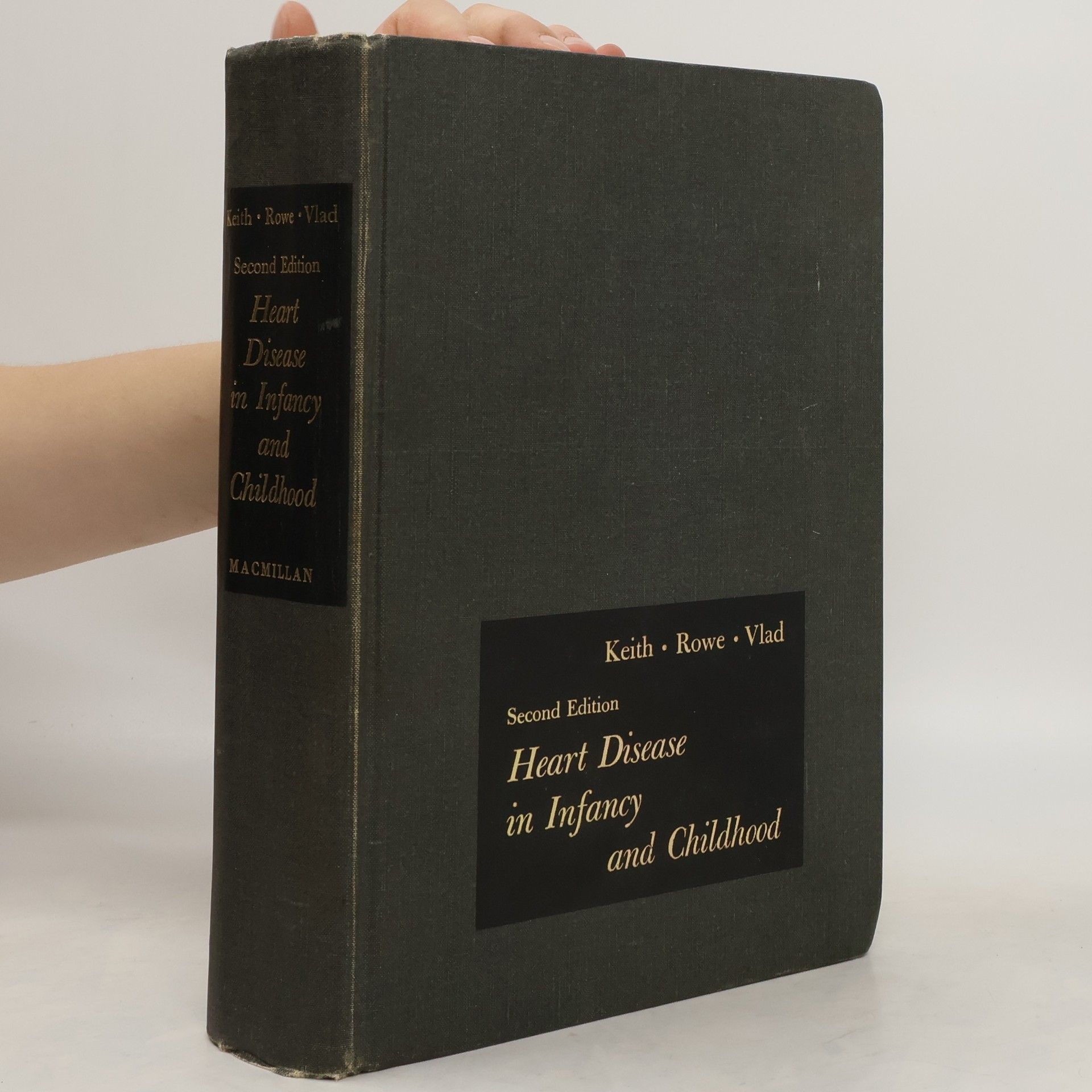 John D. Keith Heart Disease in Infancy and Childhood
