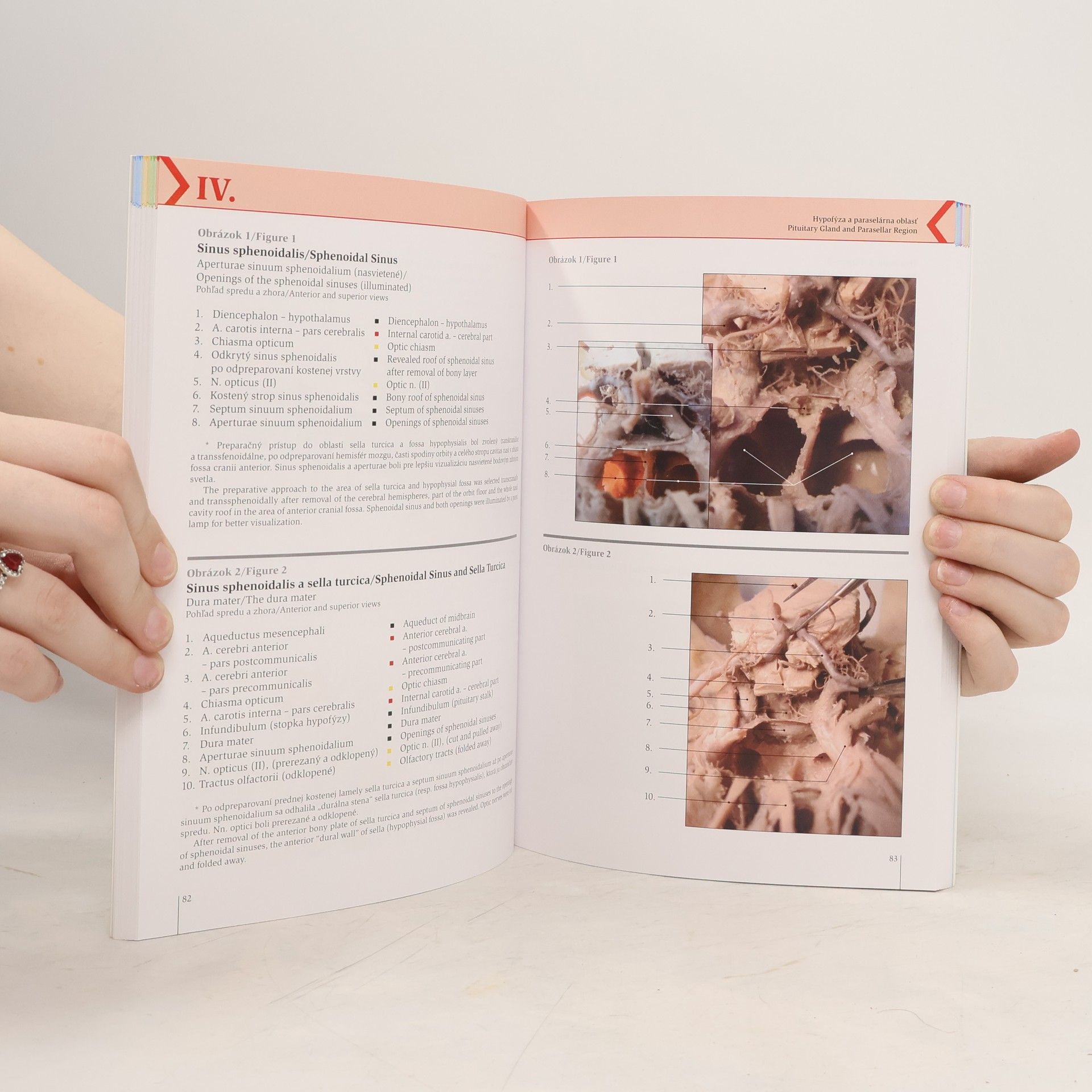 Typopress Topografická anatómia ťažko prístupných a klinicky významných oblastí hlavy